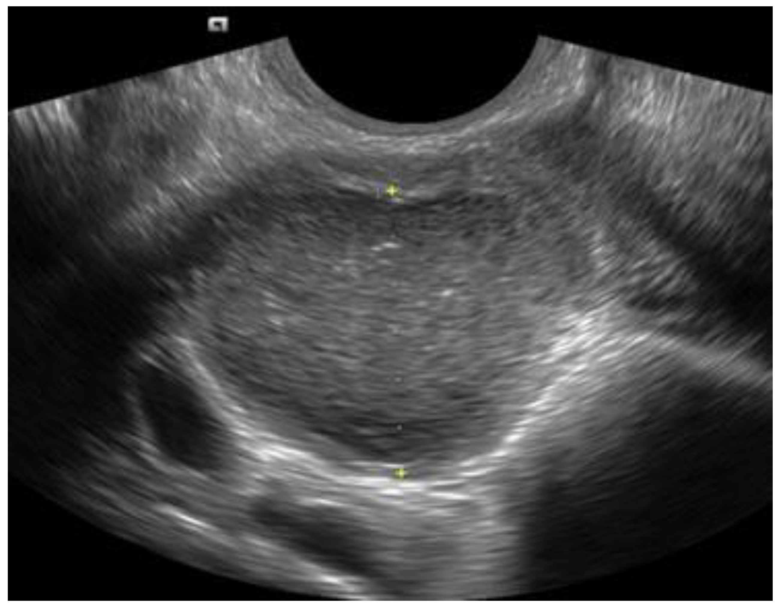 Advanced OB/GYN Ultrasound Applications