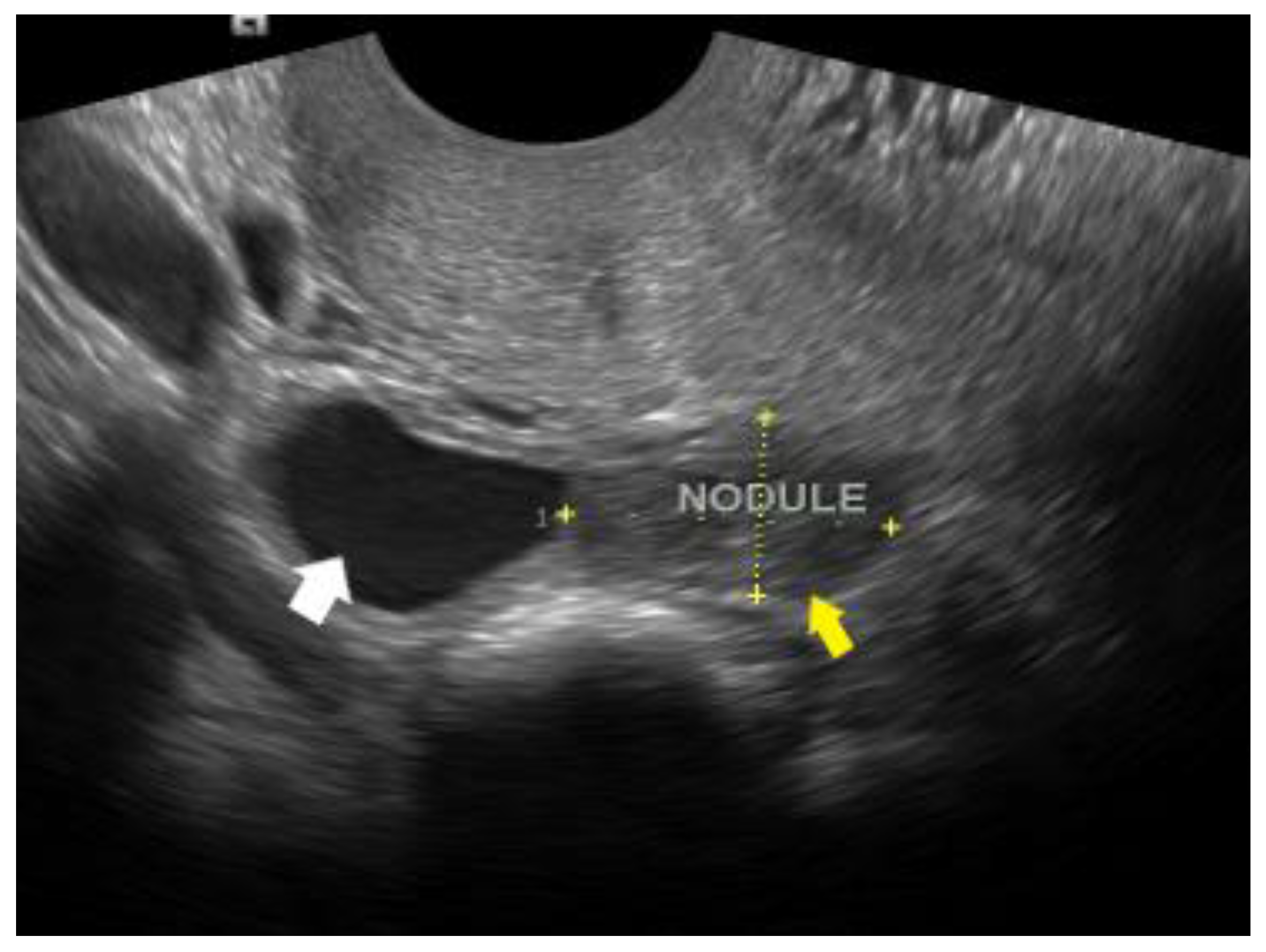 Diagnostics 12 02912 g009 Diagnostics 12 02912 g009