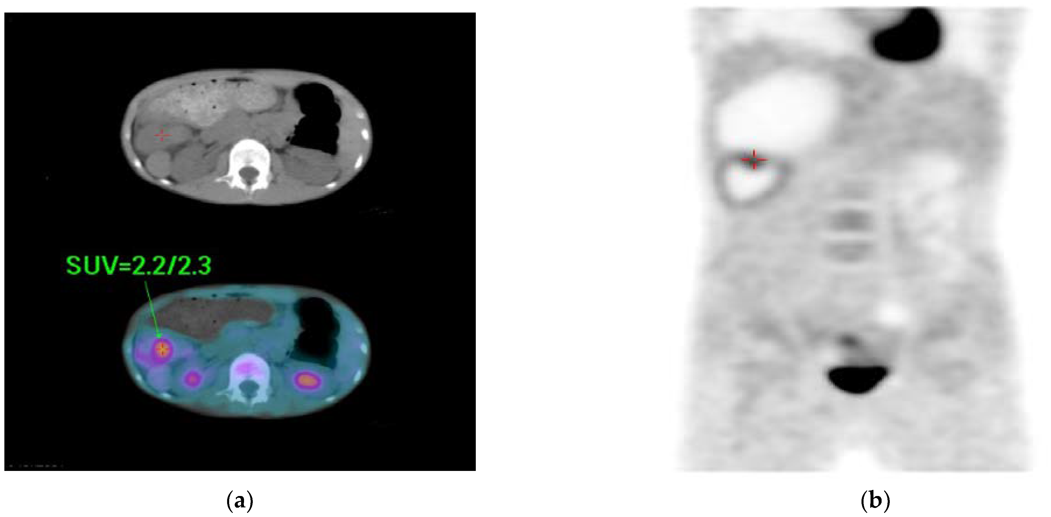 Diagnostics 12 02920 g004 Diagnostics 12 02920 g004