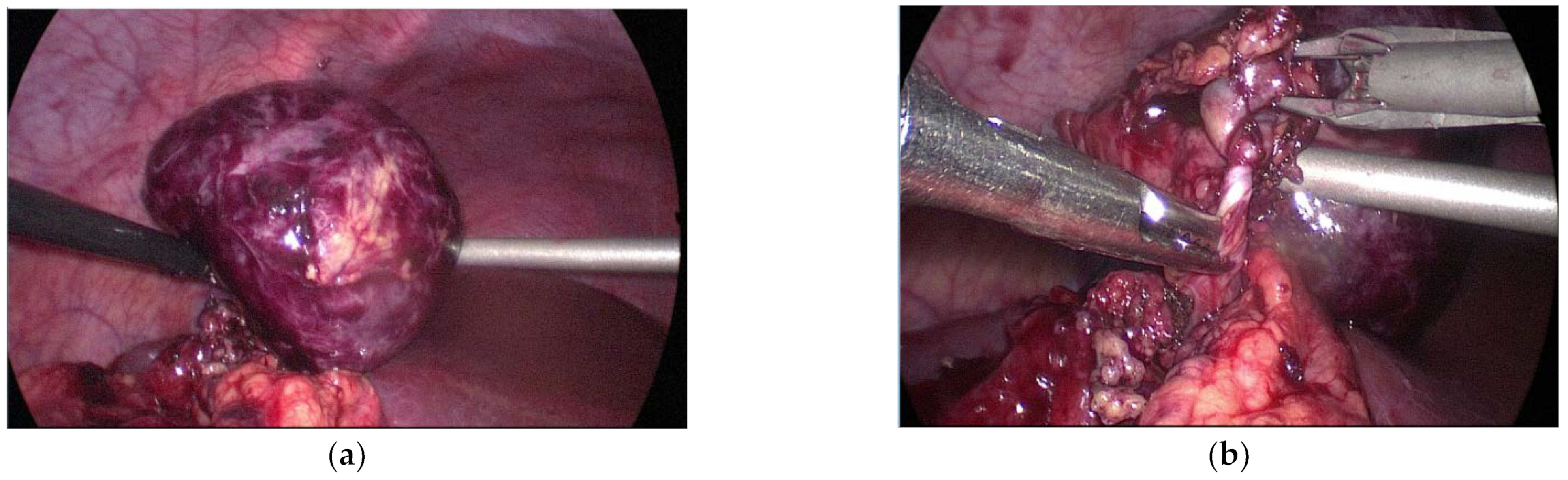 Diagnostics 12 02920 g005 Diagnostics 12 02920 g005