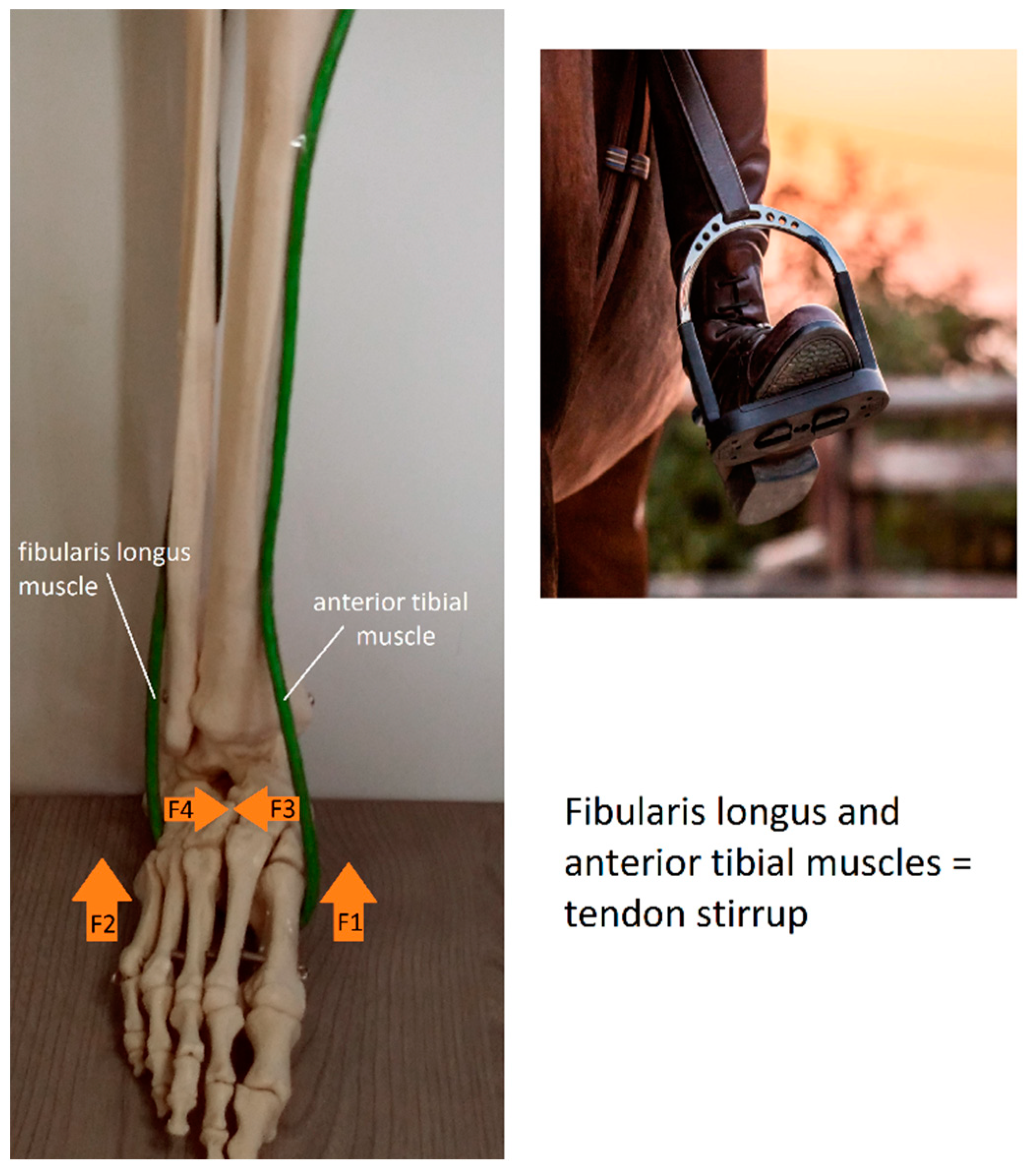Foot arch clearance muscles