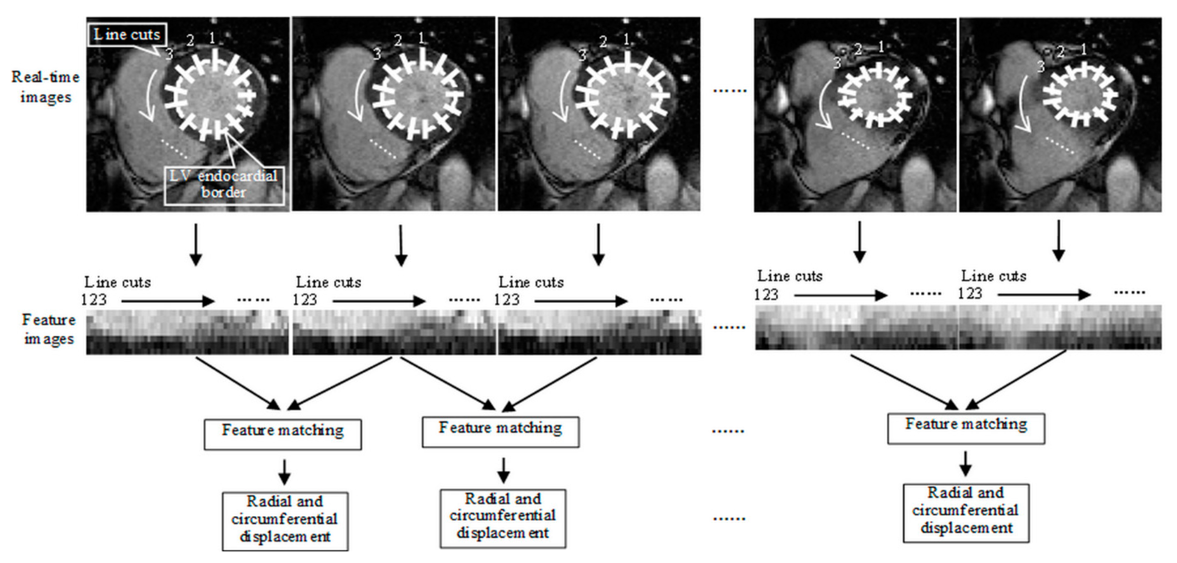 Diagnostics Free FullText Left Ventricle Wall Motion Analysis with