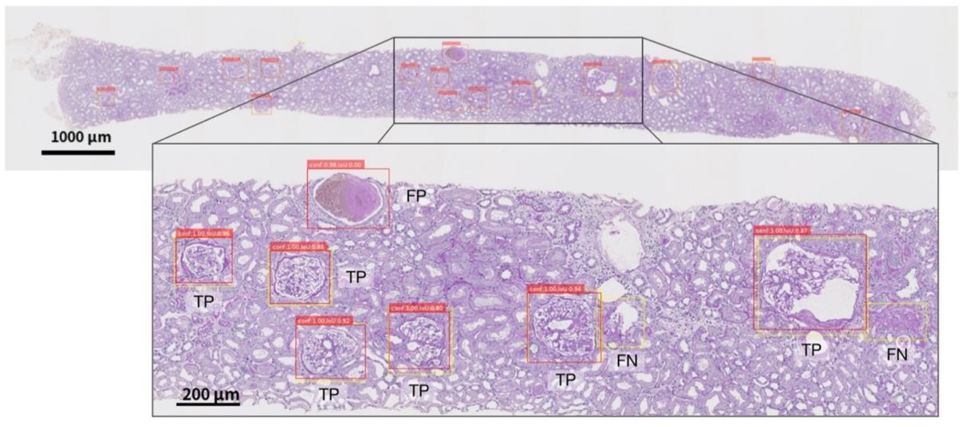 Diagnostics 12 02955 g0a2