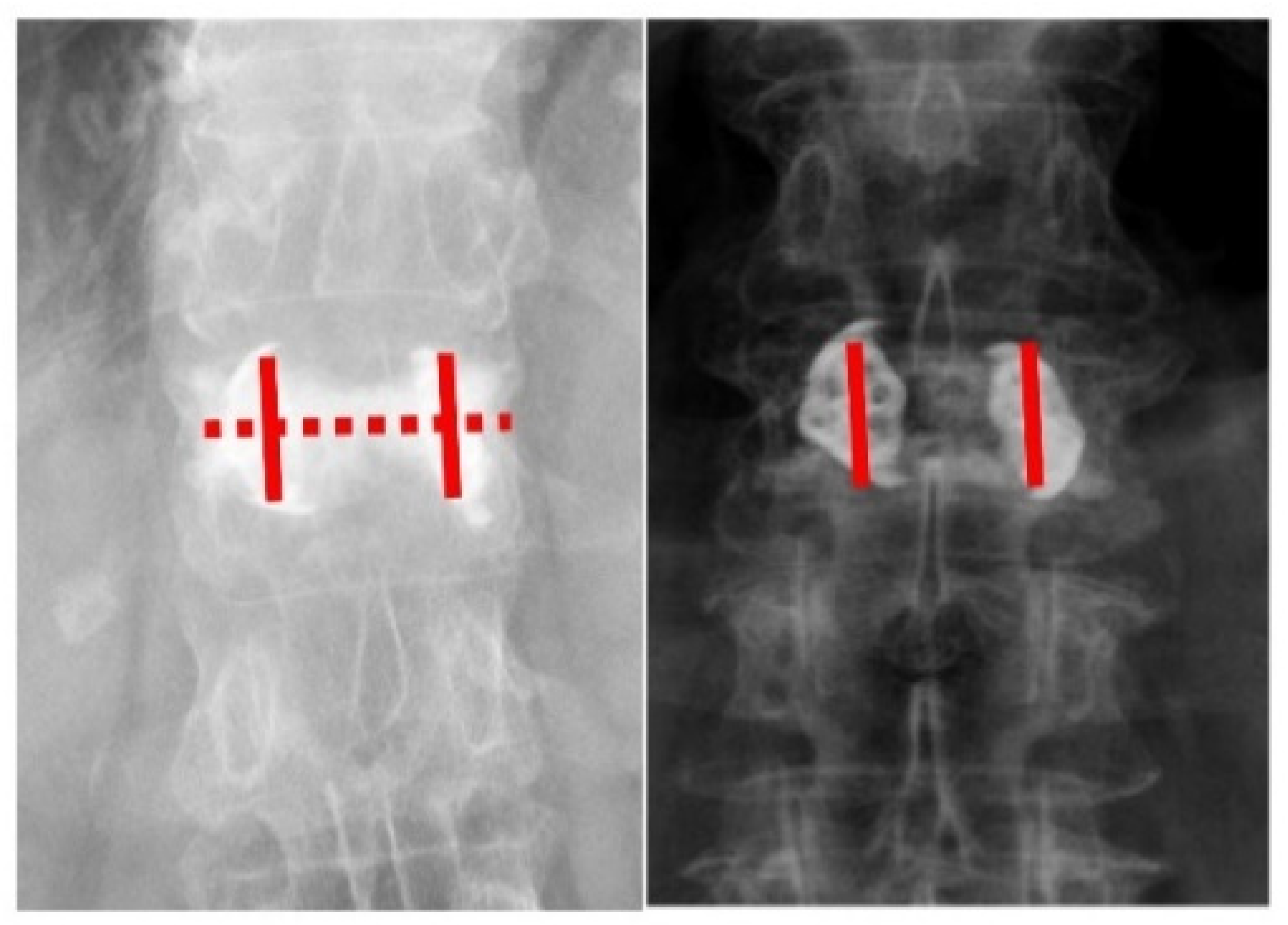 Diagnostics 12 03068 g002 Diagnostics 12 03068 g002