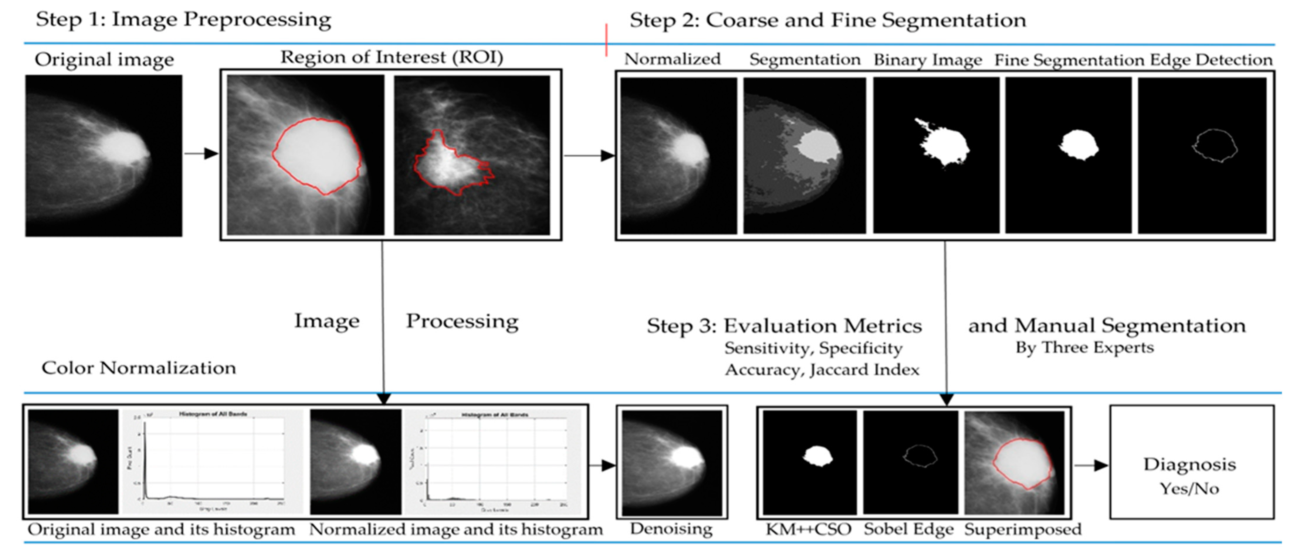 Breast Cancer Detection in Mammogram Images Using K–Means++ Clustering ...