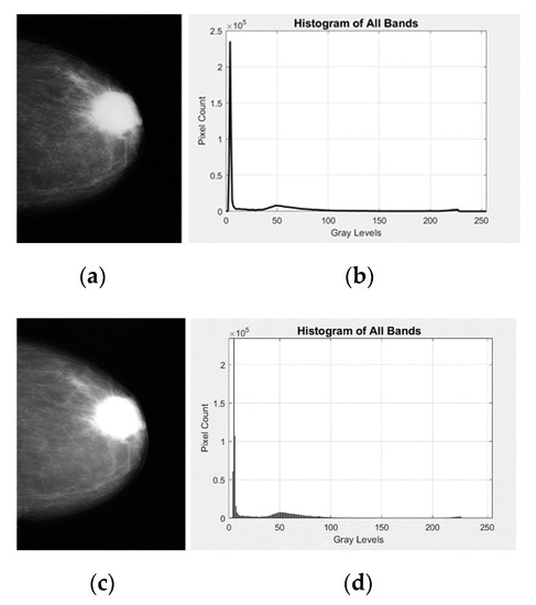 Breast Cancer Detection in Mammogram Images Using K–Means++ Clustering ...