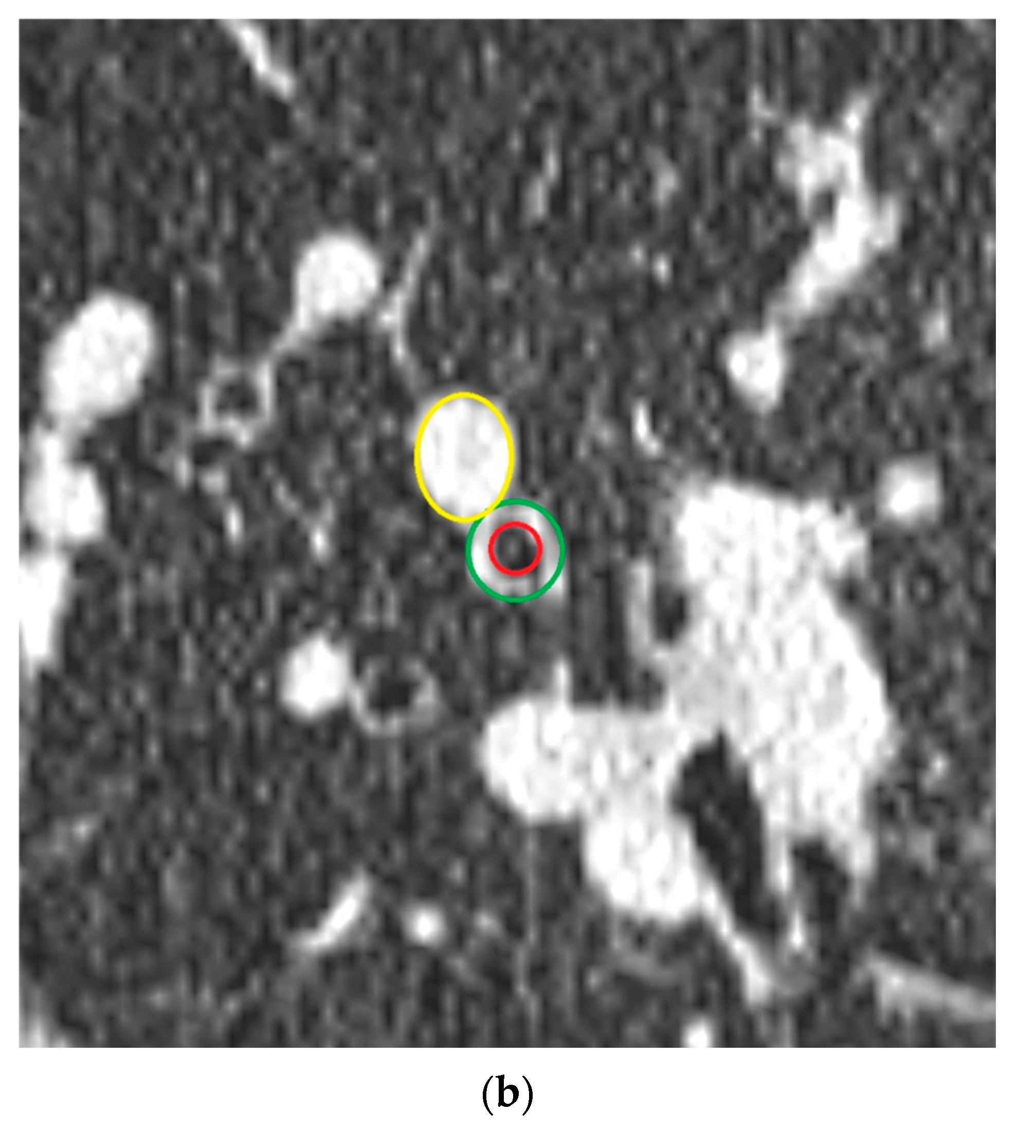 Diagnostics 12 03096 g003b