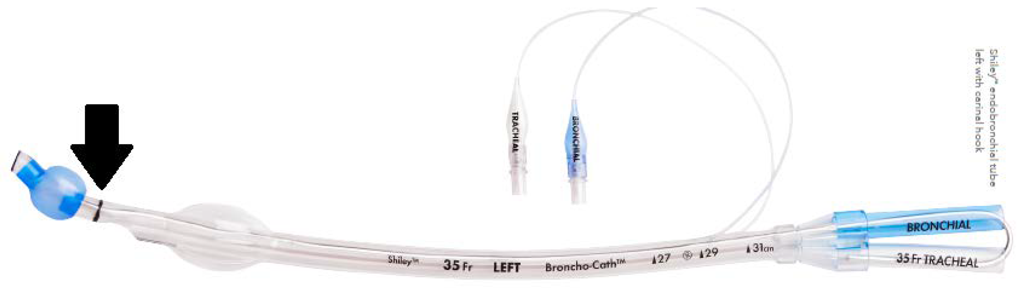 Two Lumen J Tube
