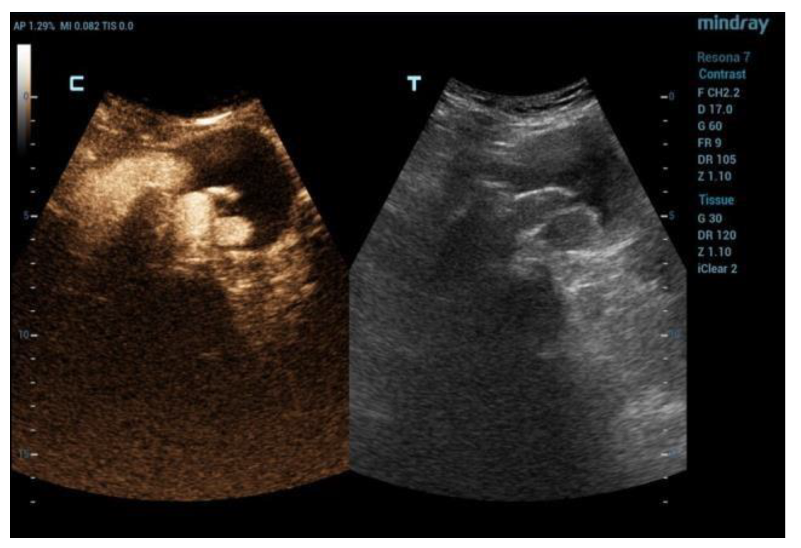 Diagnostics 12 03173 g002