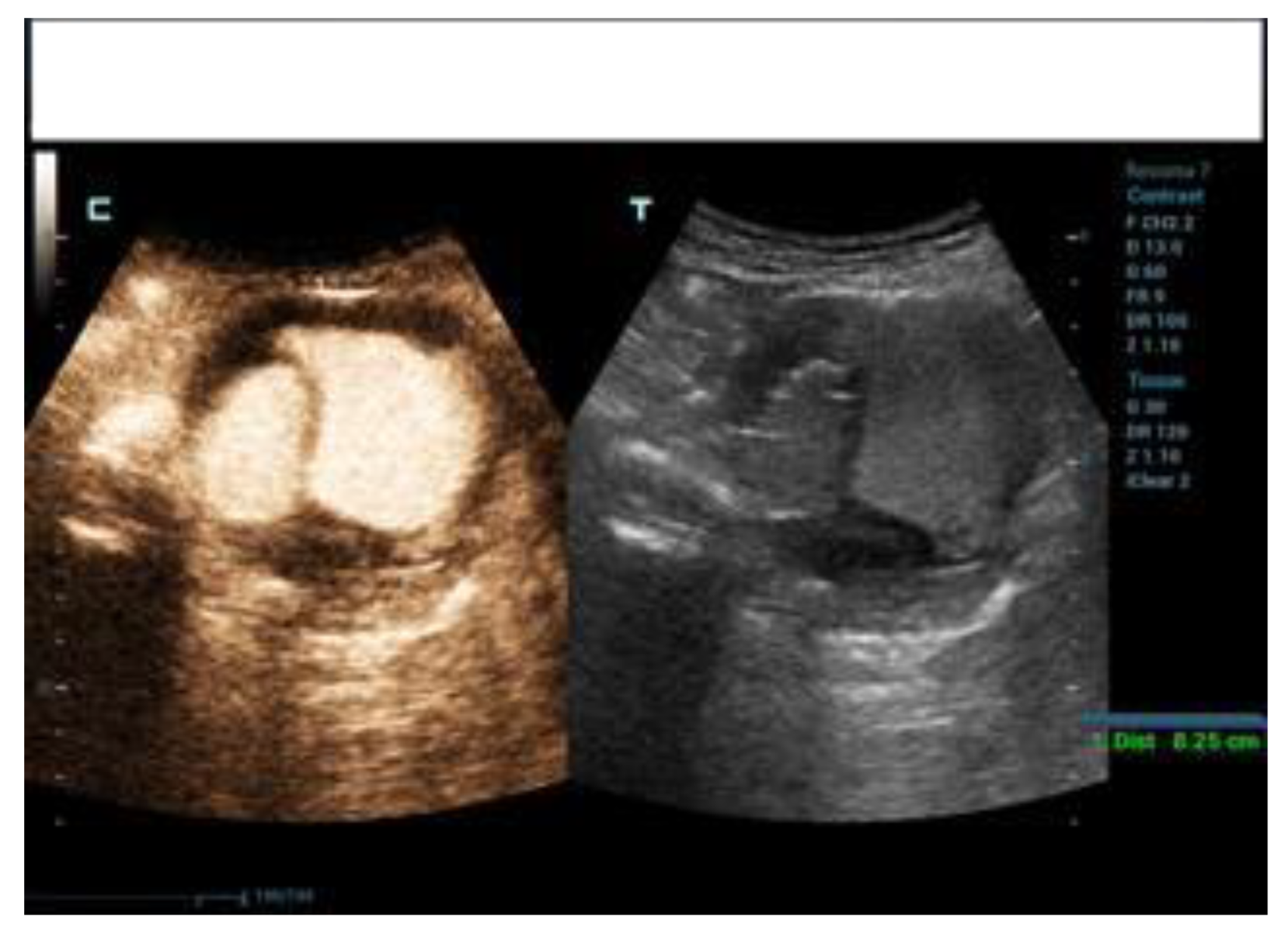 Diagnostics 12 03173 g004