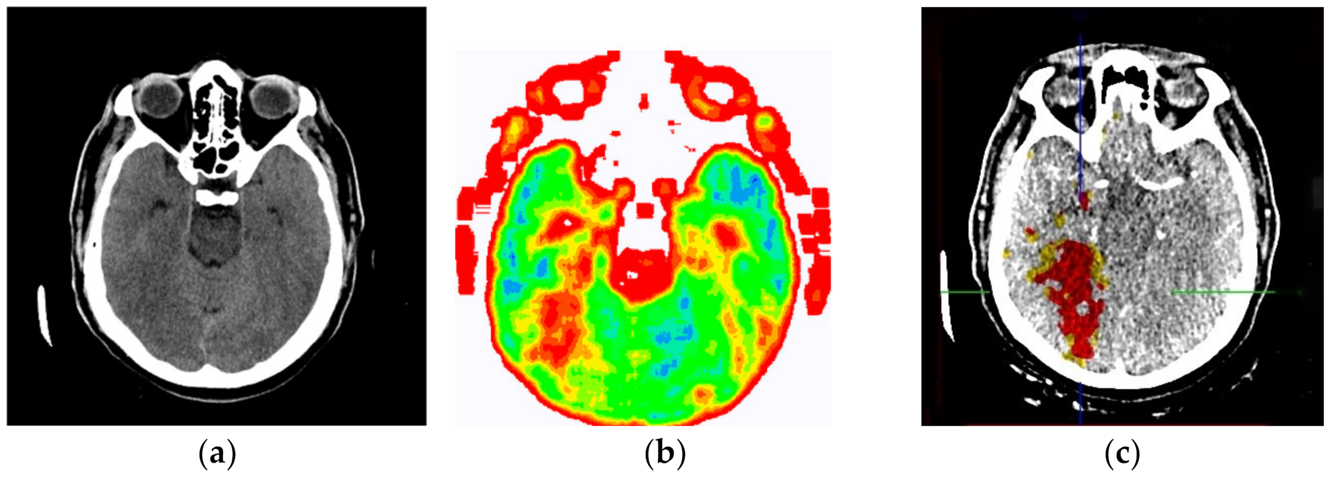 Diagnostics 12 03208 g013