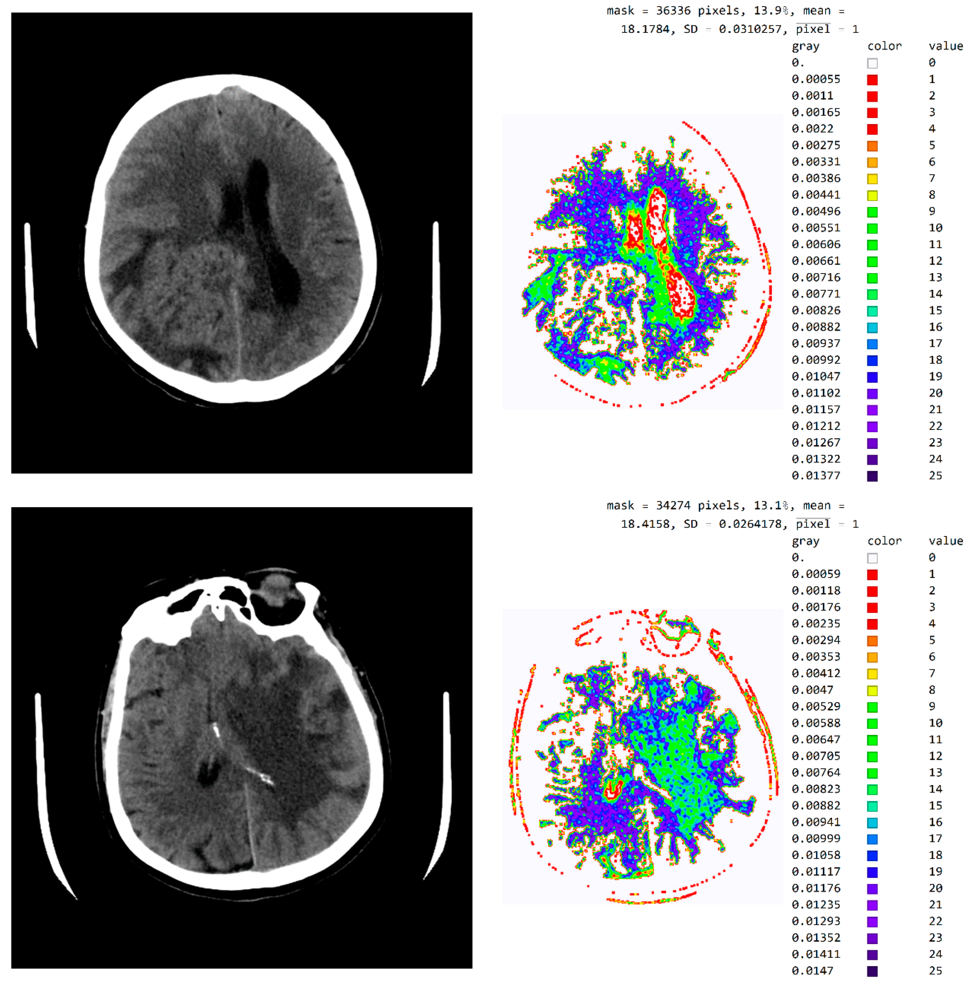 Diagnostics 12 03208 g0a3a