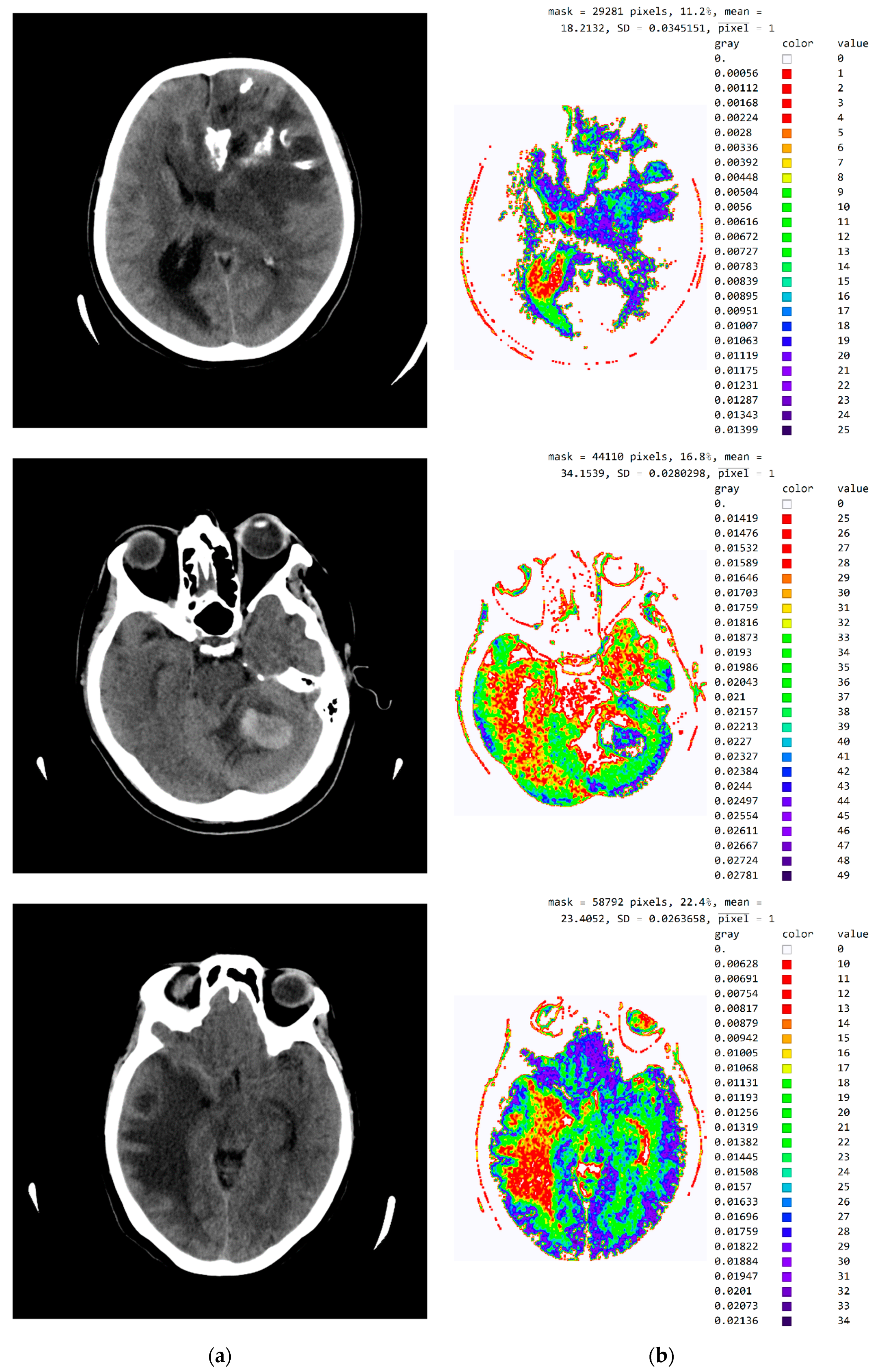 Diagnostics 12 03208 g0a3b