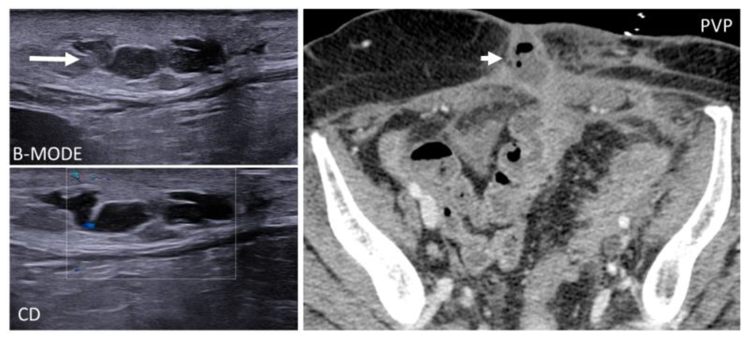 Suspect flank pain? Consider ultrasound for first-line imaging • APPLIED  RADIOLOGY