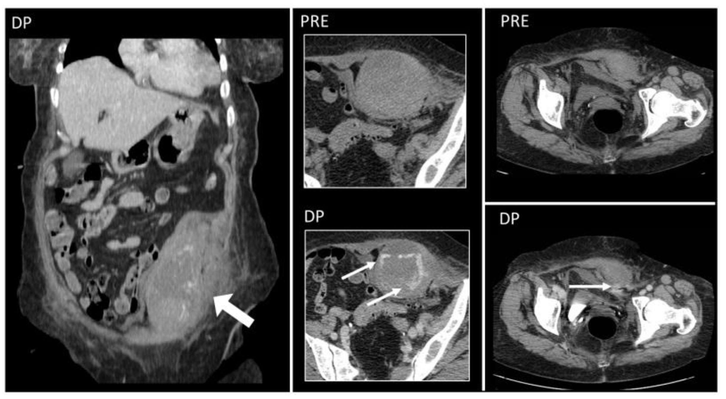 Diagnostics 12 03211 g011