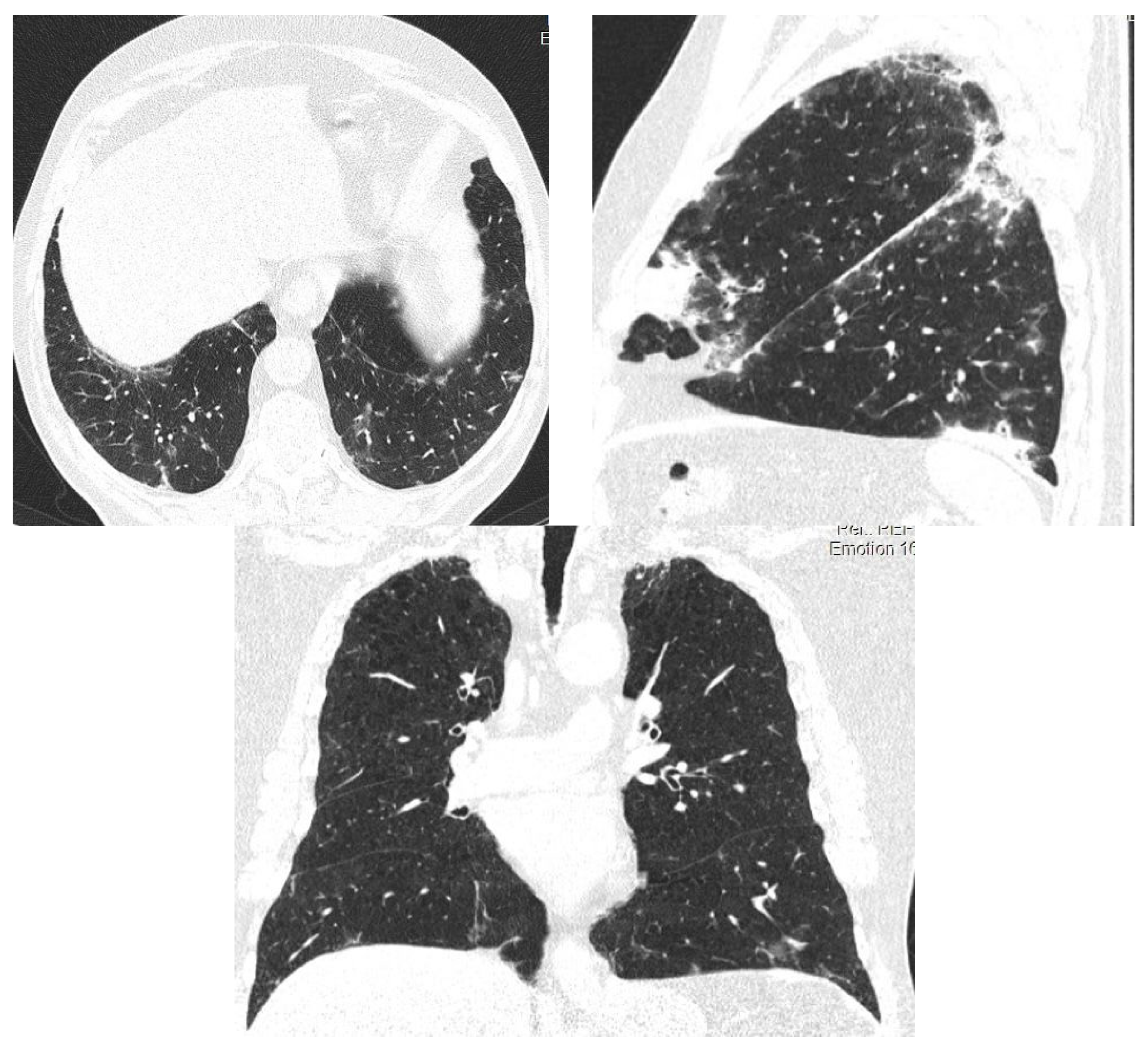 Diagnostics 12 03217 g003 Diagnostics 12 03217 g003