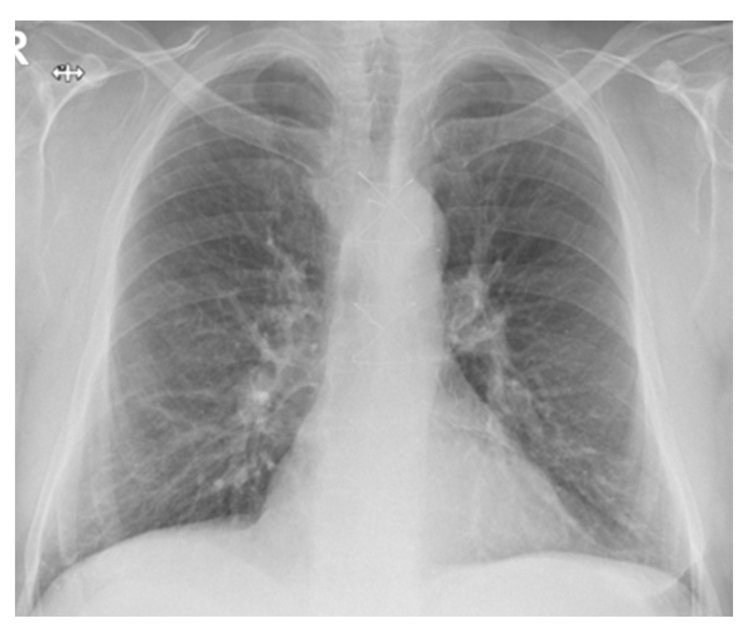 Diagnostics 12 03217 g004 Diagnostics 12 03217 g004