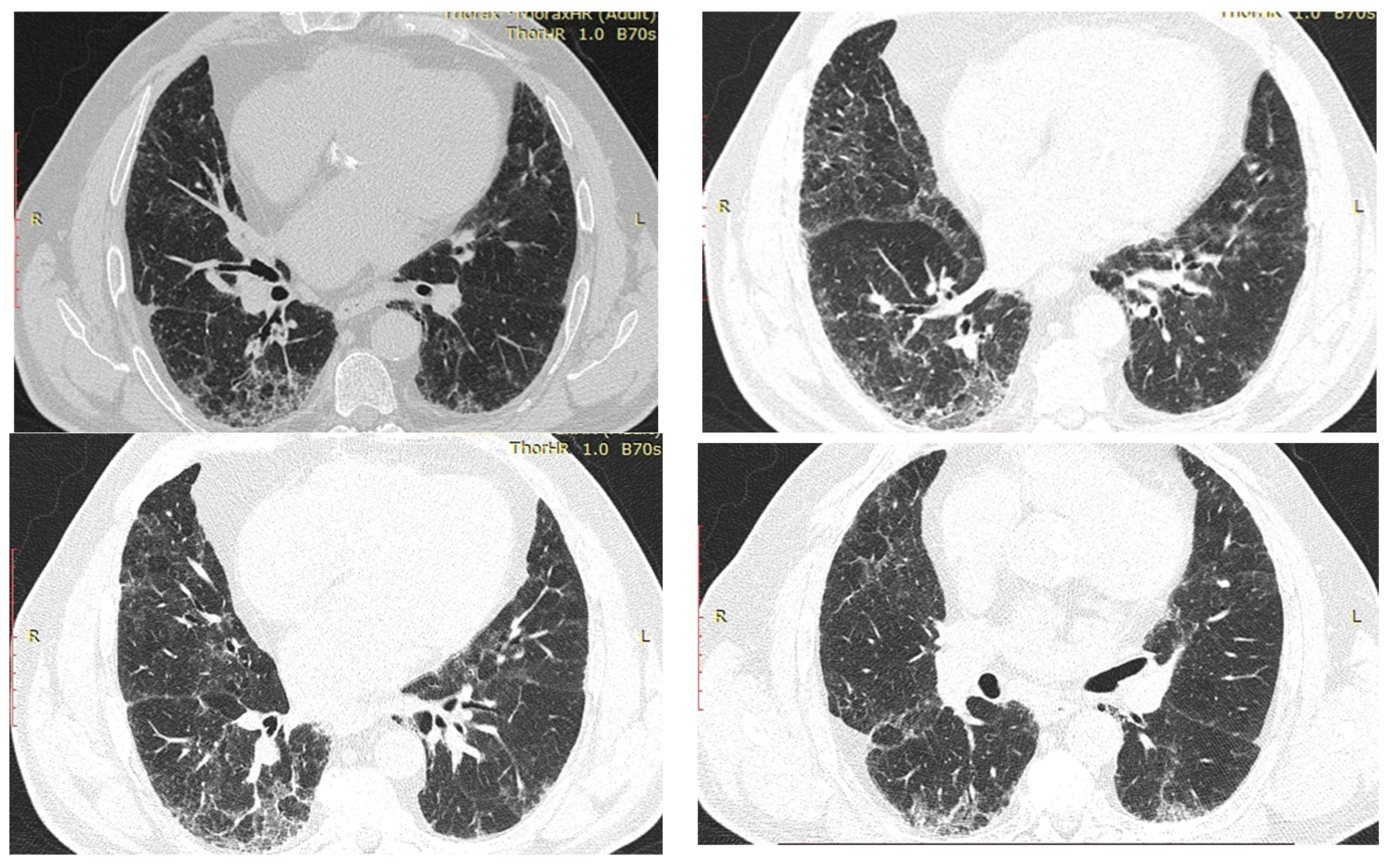 Diagnostics 12 03217 g005 Diagnostics 12 03217 g005