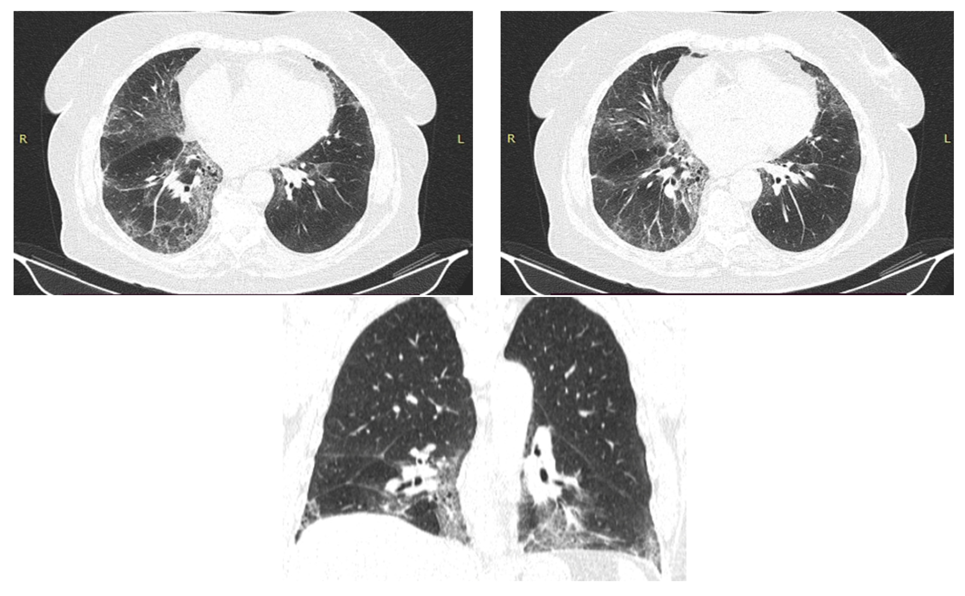 Diagnostics 12 03217 g007 Diagnostics 12 03217 g007