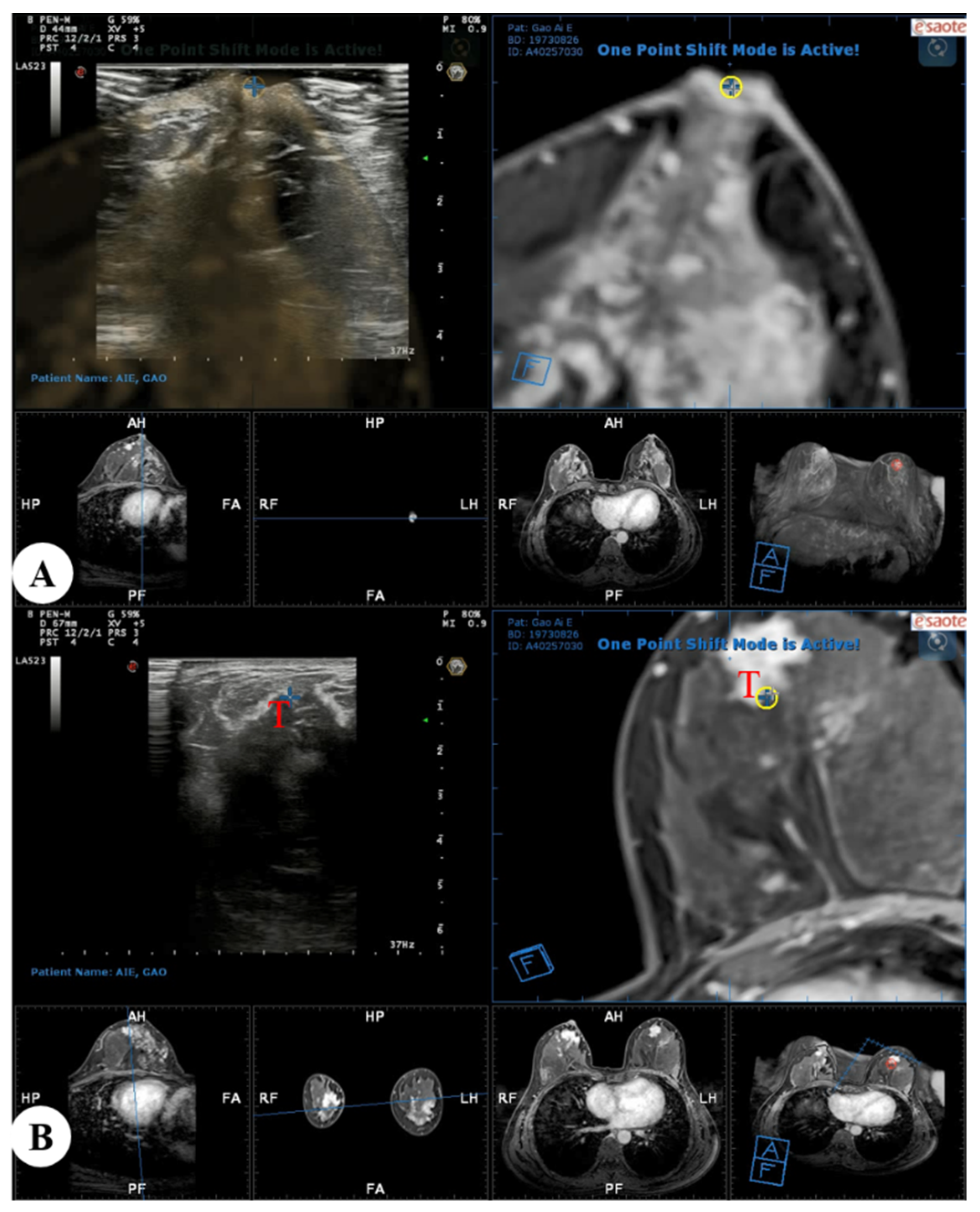 Diagnostics 13 00029 g003