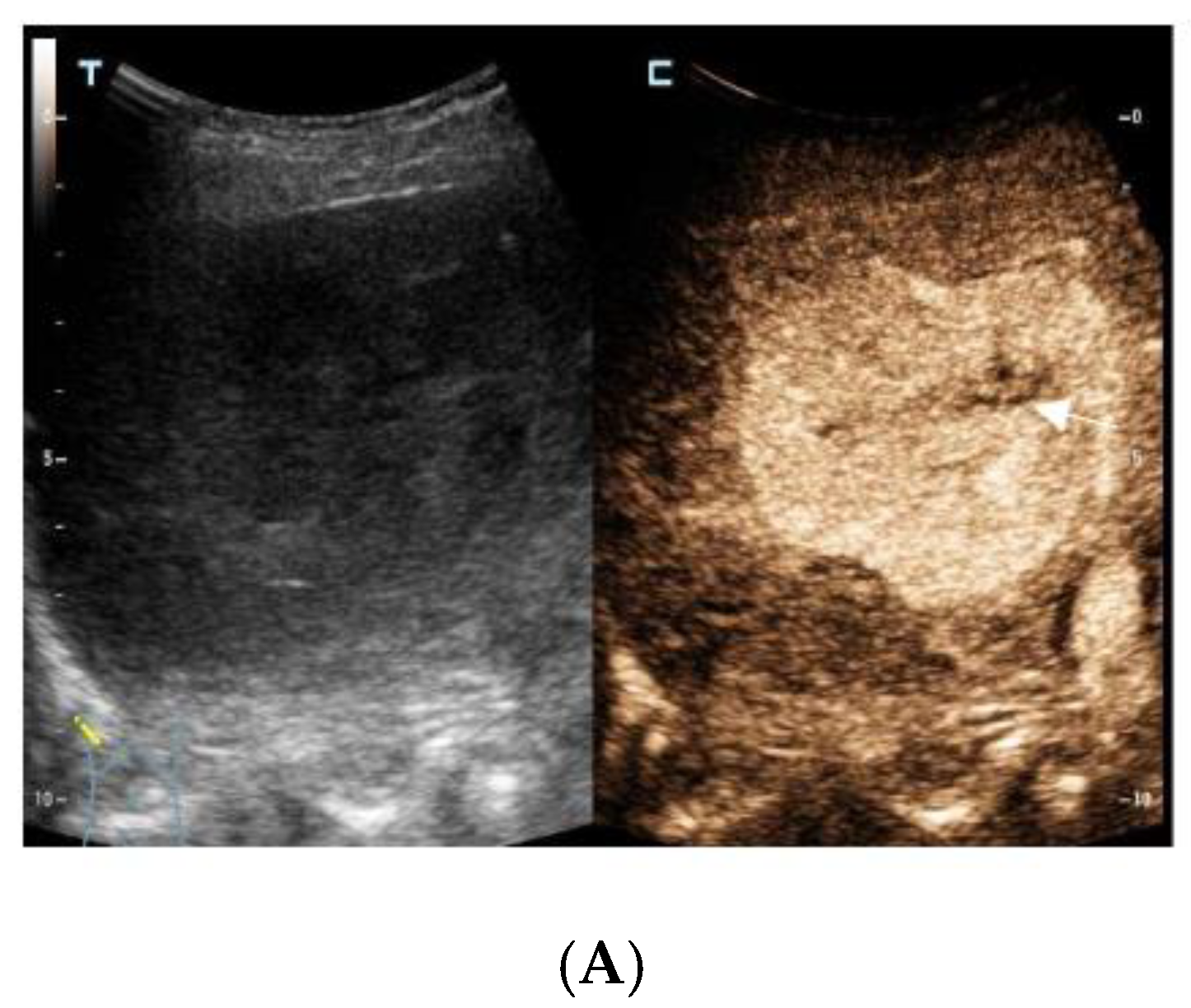 Diagnostics 13 00042 g001a Diagnostics 13 00042 g001a