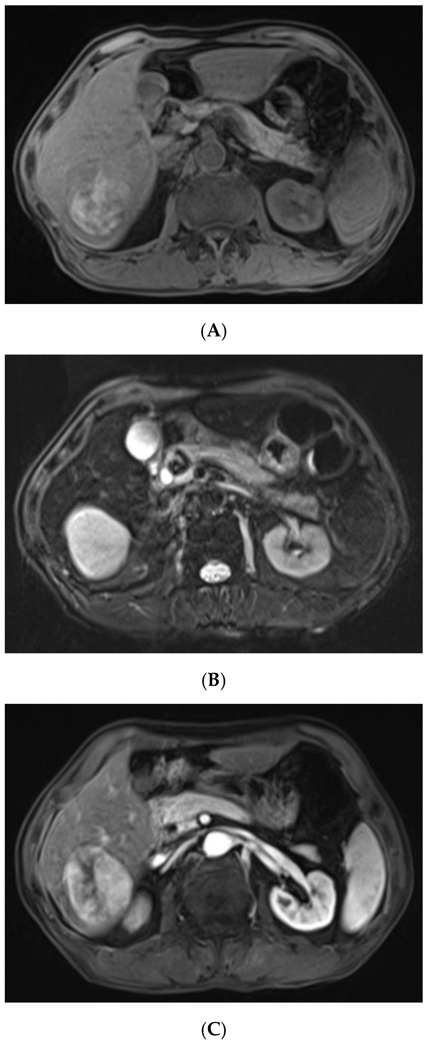 Diagnostics 13 00042 g002a Diagnostics 13 00042 g002a