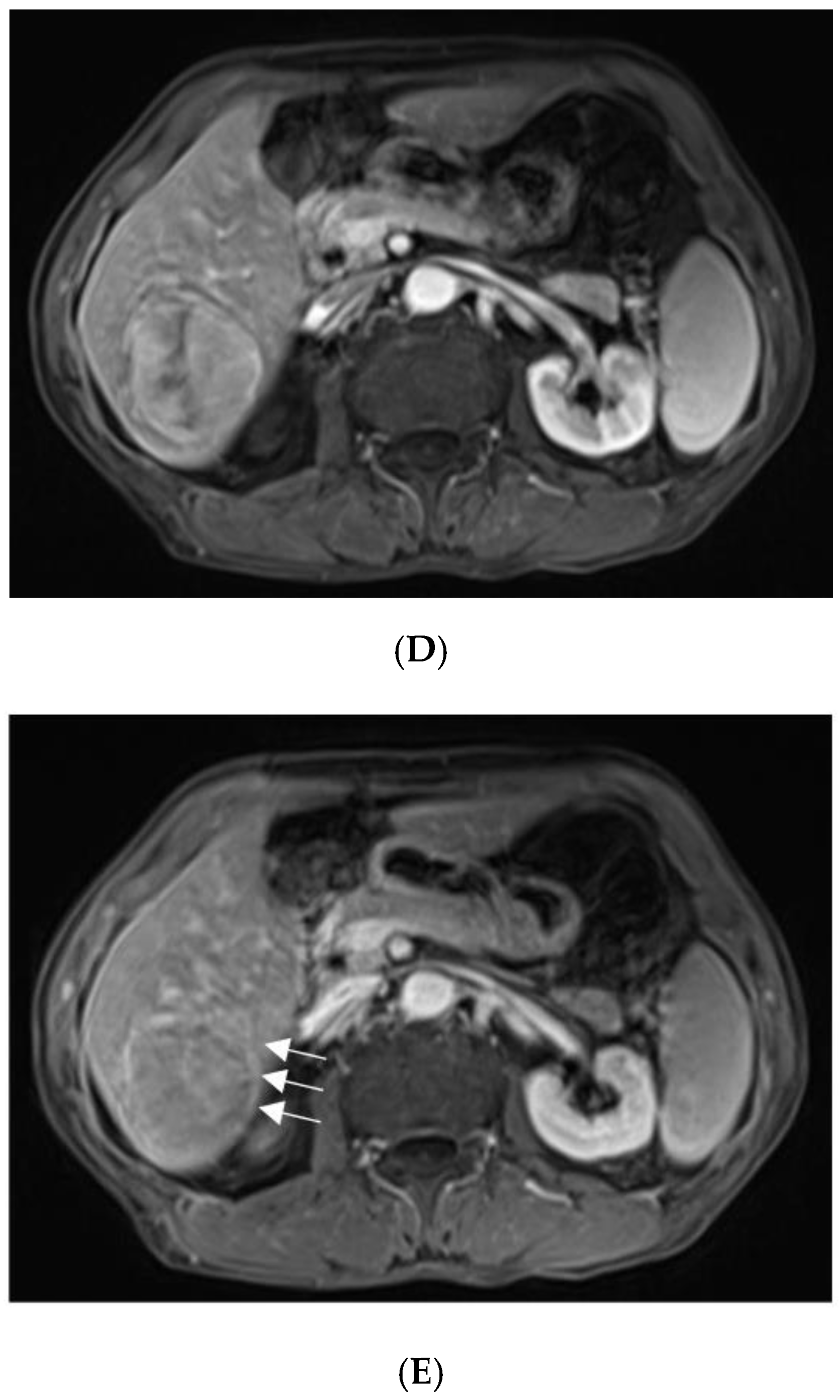 Diagnostics 13 00042 g002b Diagnostics 13 00042 g002b