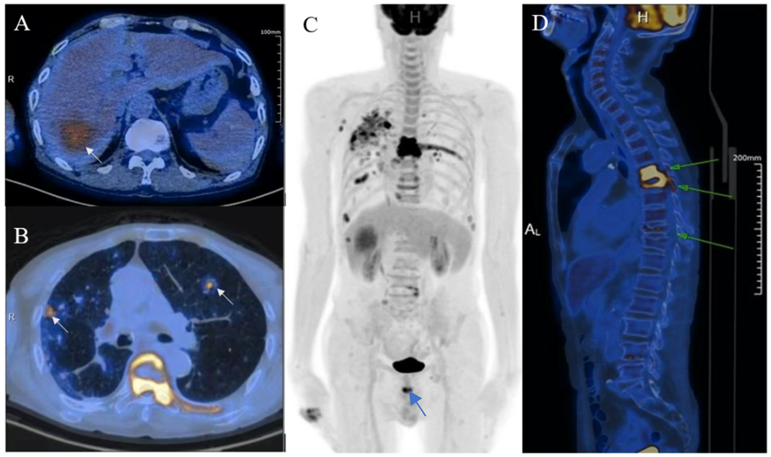 Diagnostics 13 00042 g003 Diagnostics 13 00042 g003