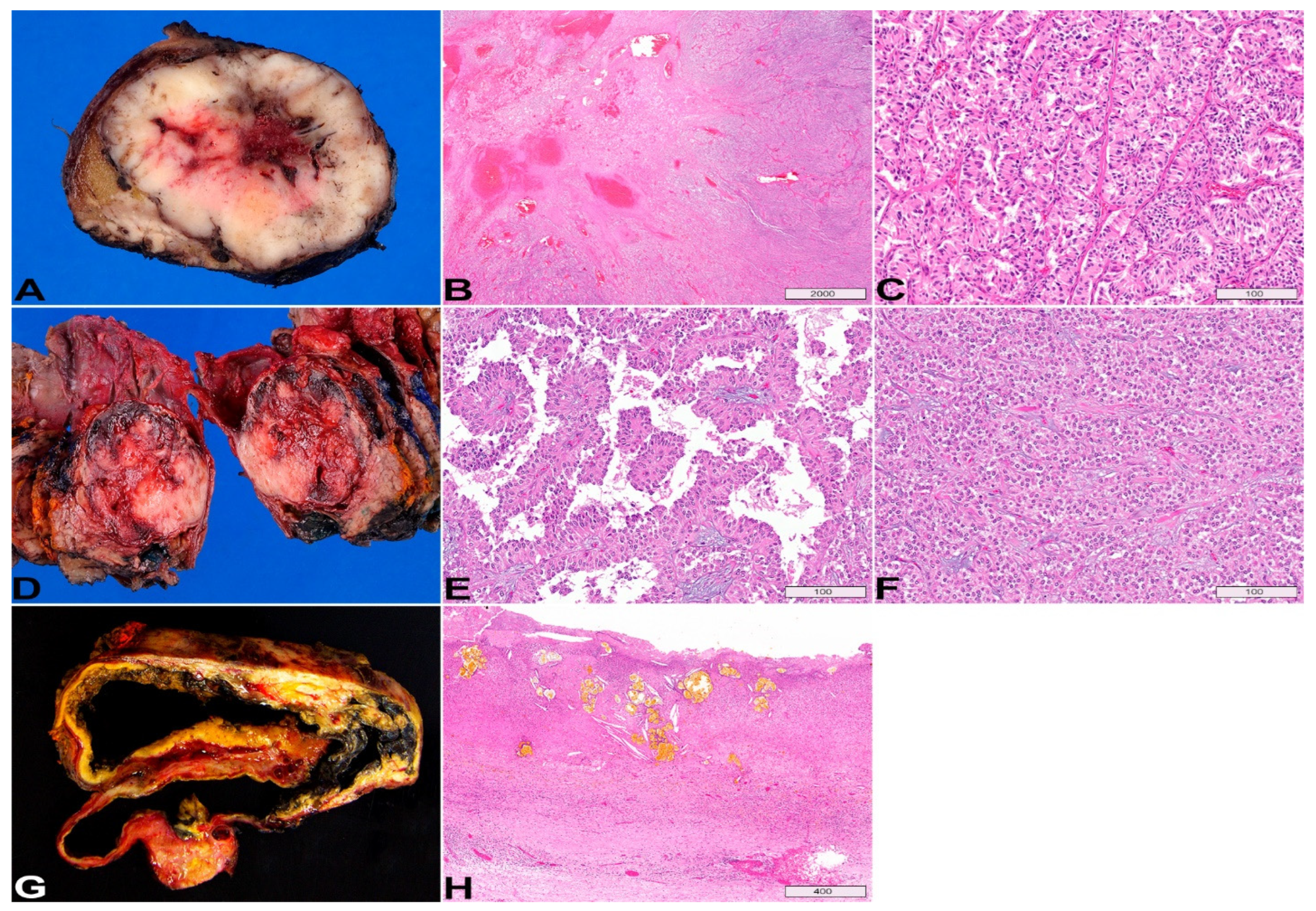 Diagnostics 13 00065 g007 Diagnostics 13 00065 g007