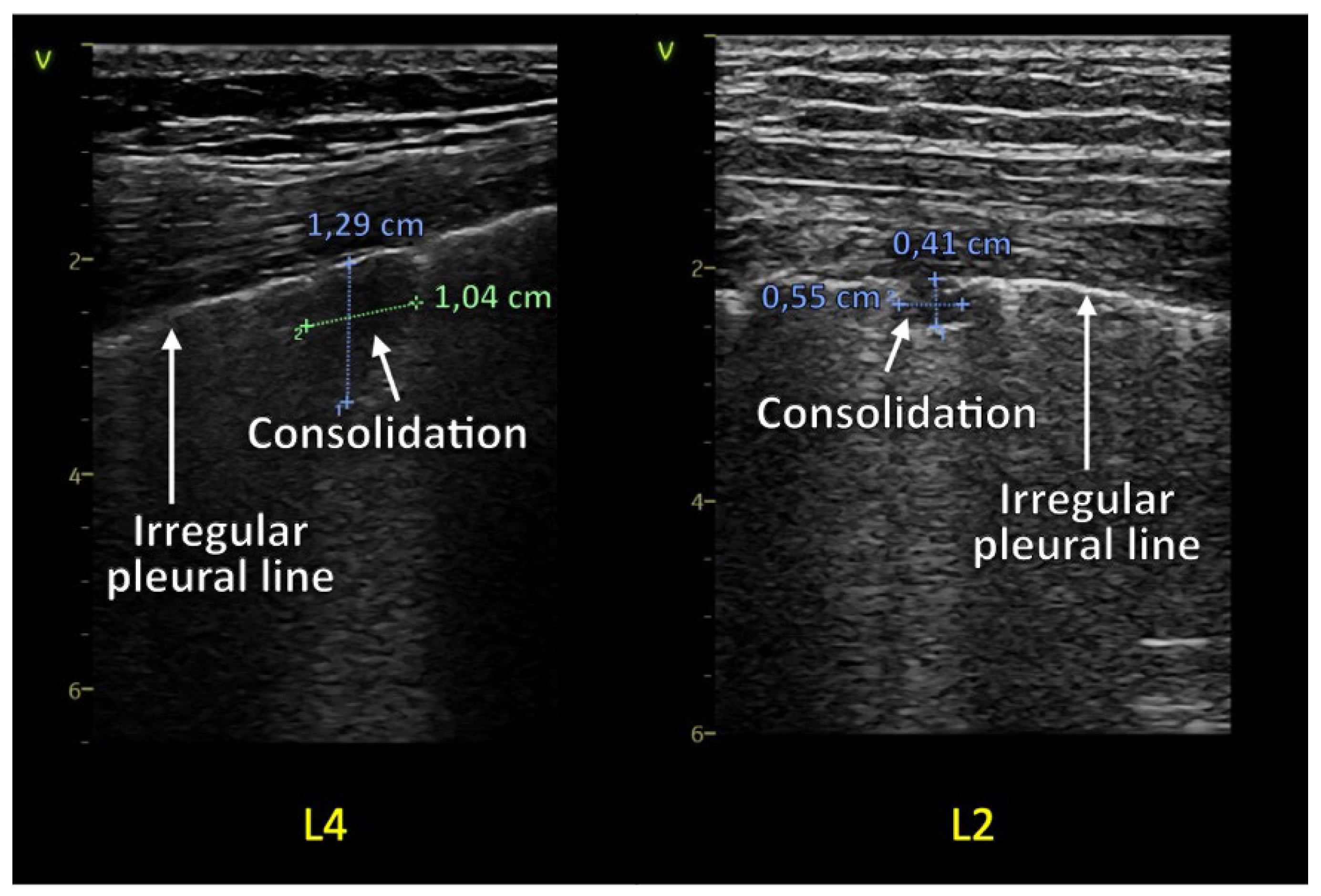 Diagnostics 13 00070 g004