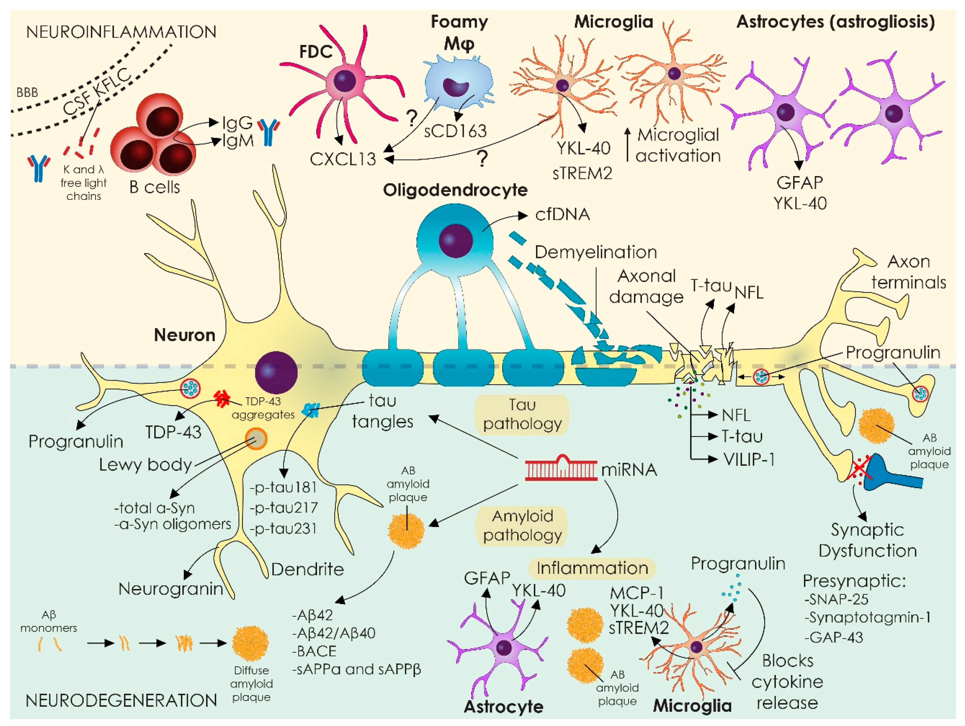 NfL as a biomarker for neurodegeneration and survival in Parkinson