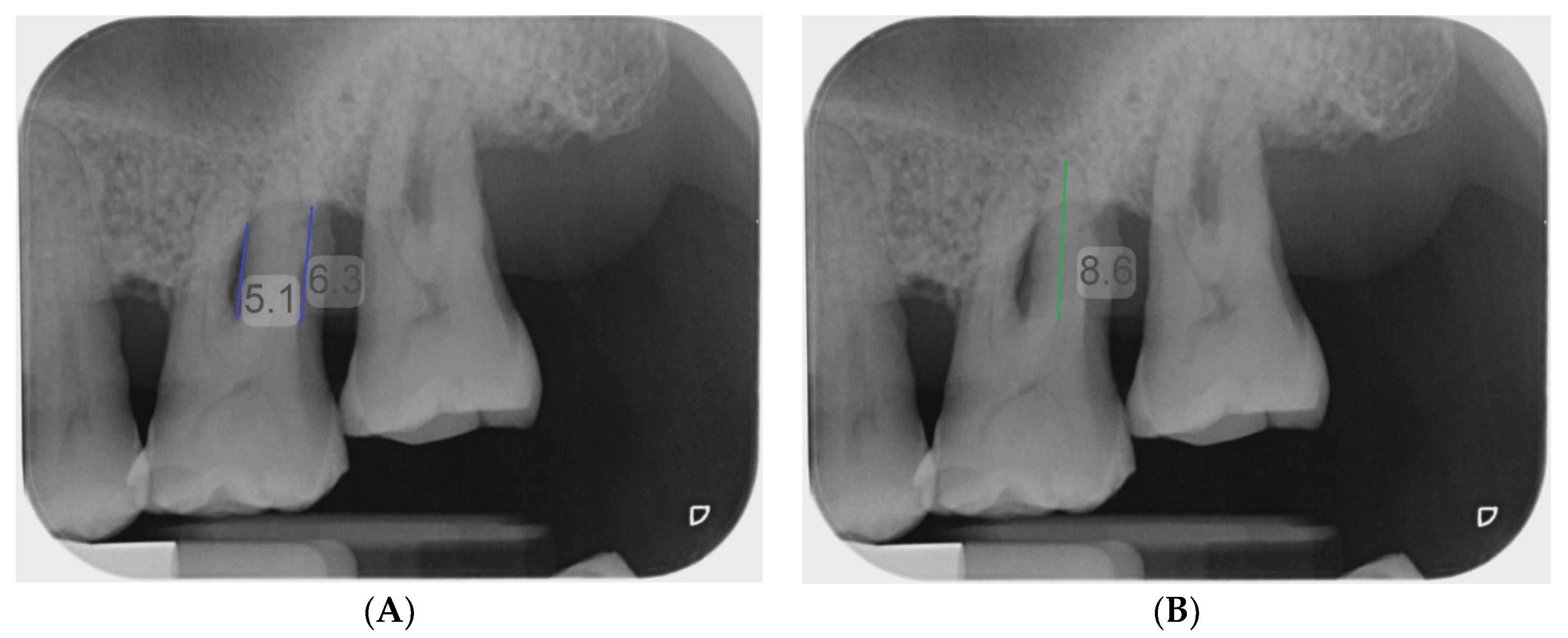 Diagnostics 13 00106 g003