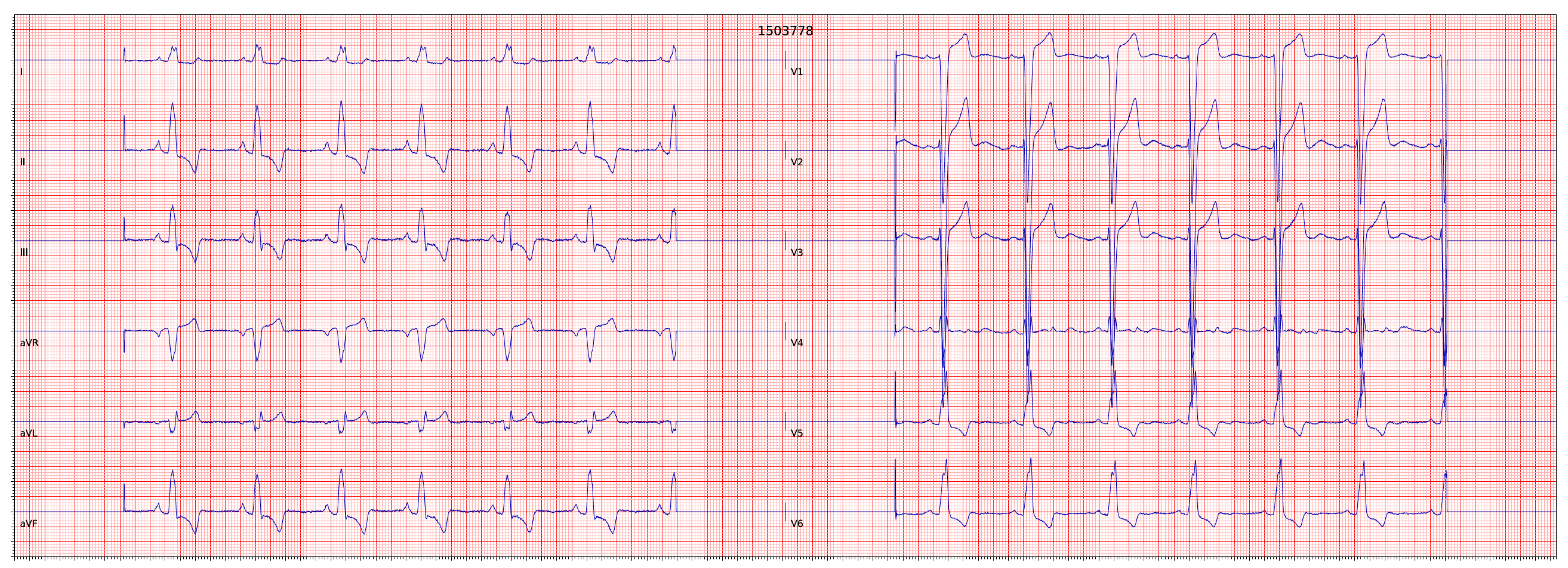 Diagnostics 13 00111 g004 Diagnostics 13 00111 g004