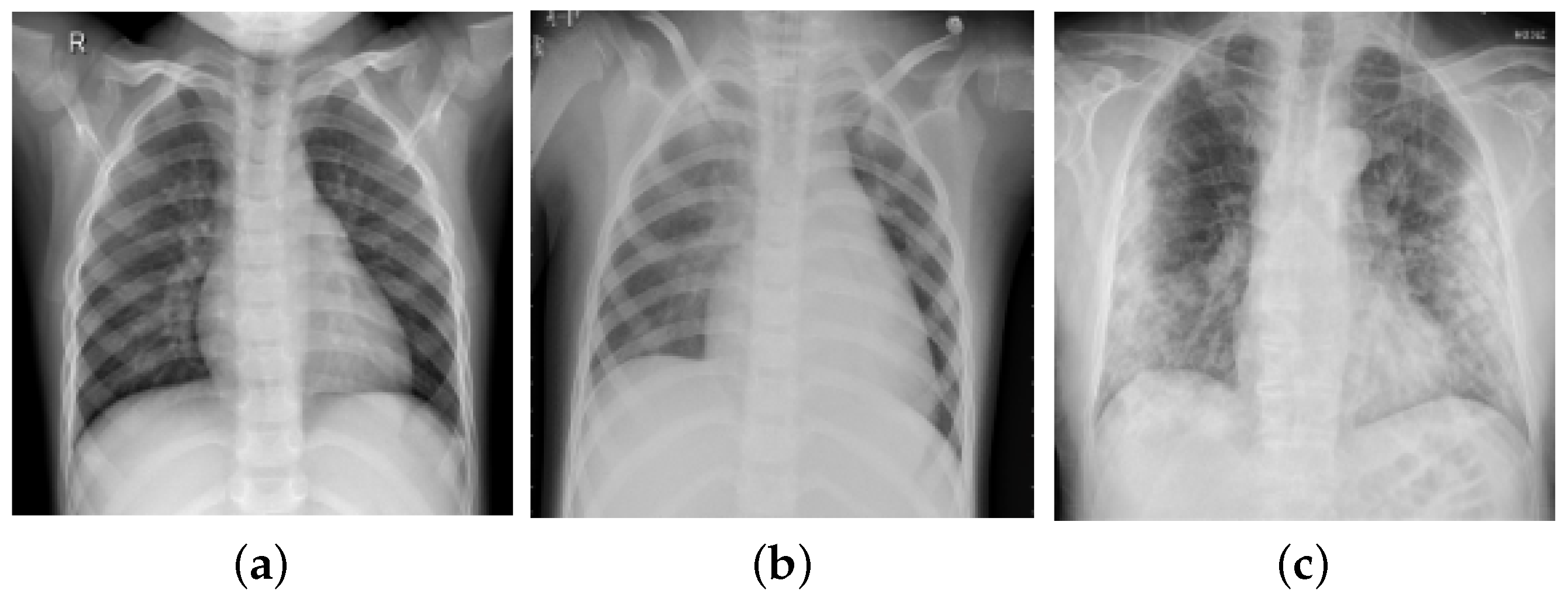 Diagnostics Free FullText An Efficient Deep Learning Method for Detection of COVID19