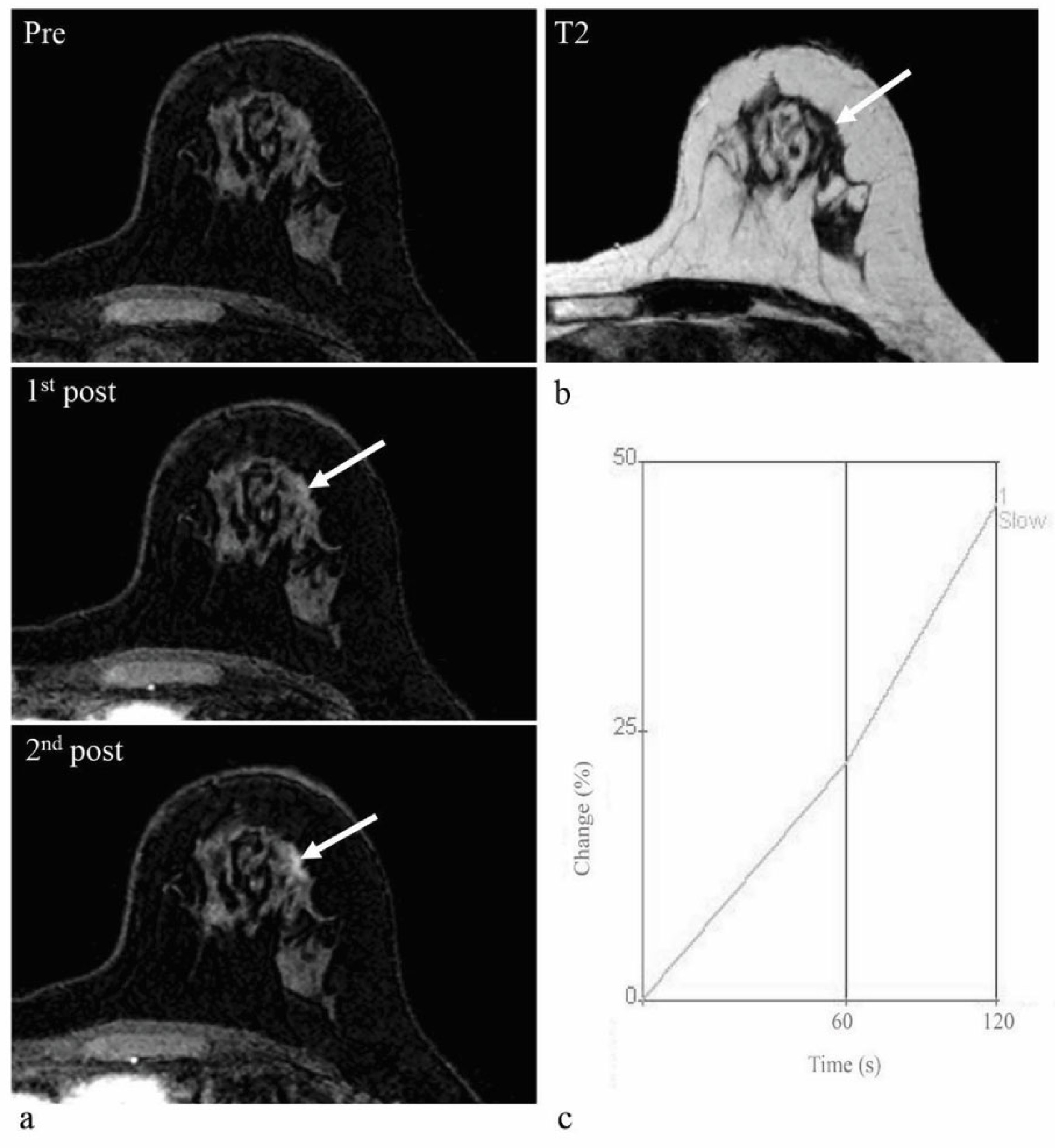 Diagnostics Free FullText Assessment of Enhancement