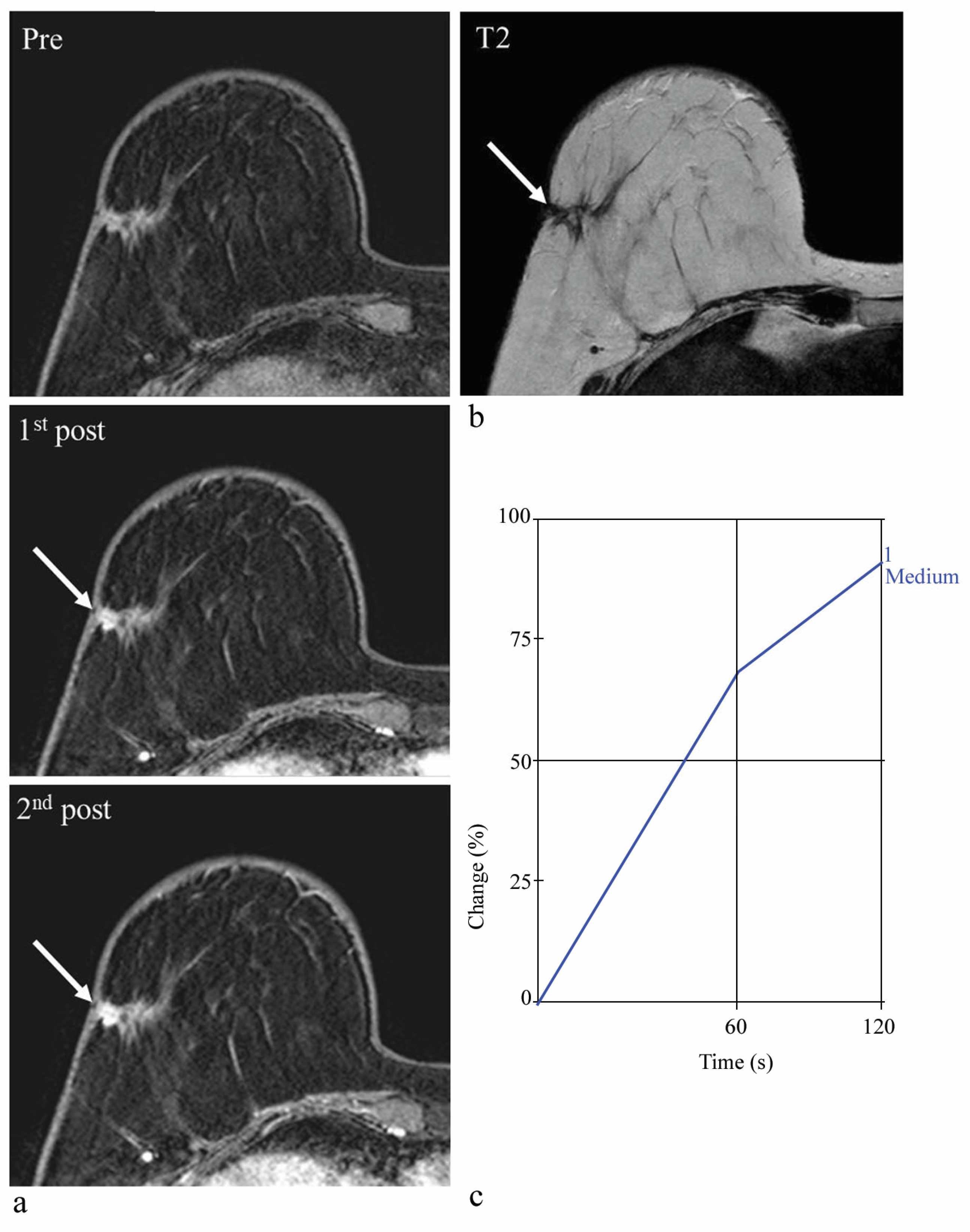 Diagnostics Free FullText Assessment of Enhancement