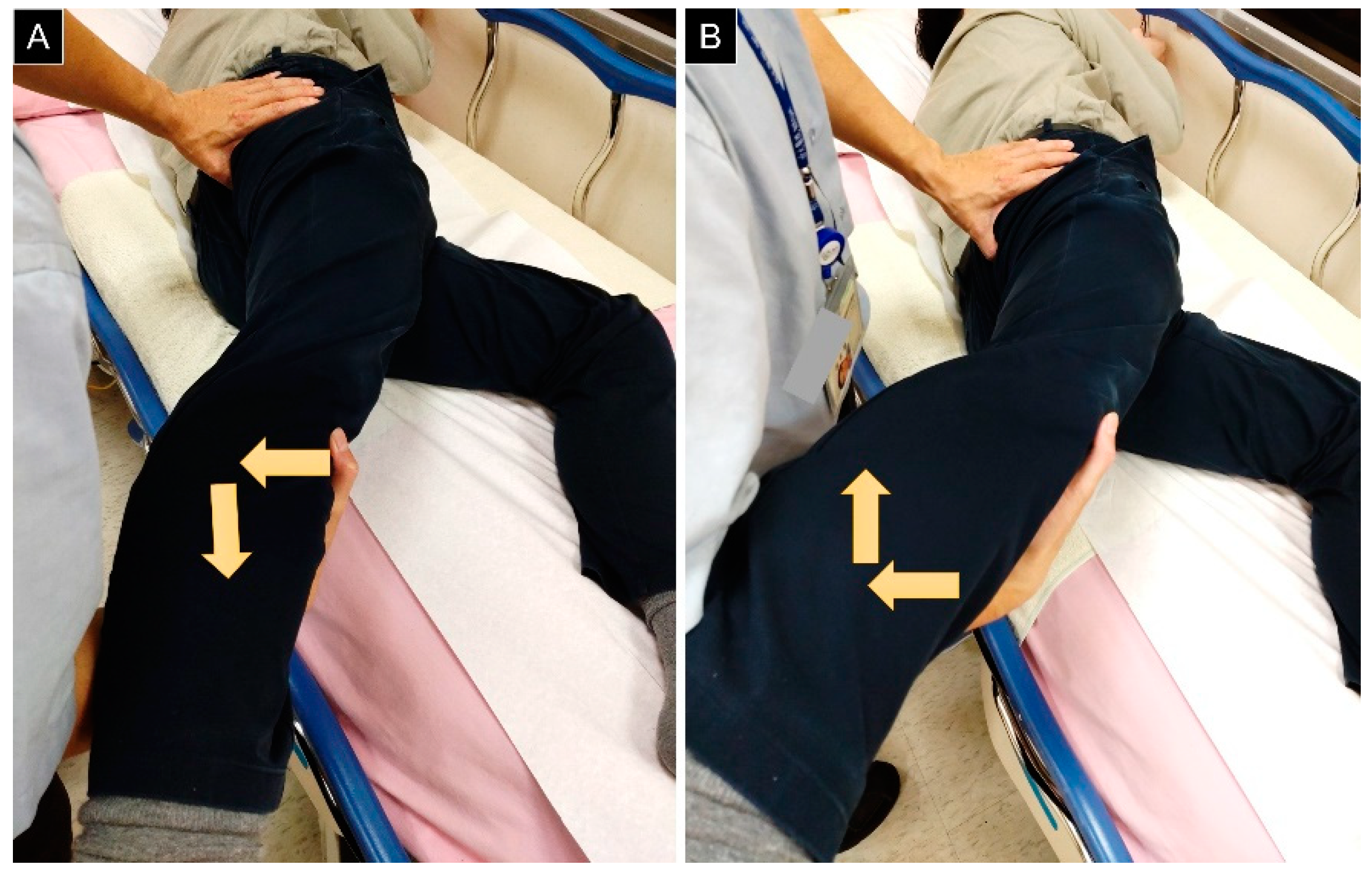 Diagnostics Free FullText Ischiofemoral Impingement Syndrome Diagnostics Free FullText Ischiofemoral Impingement Syndrome