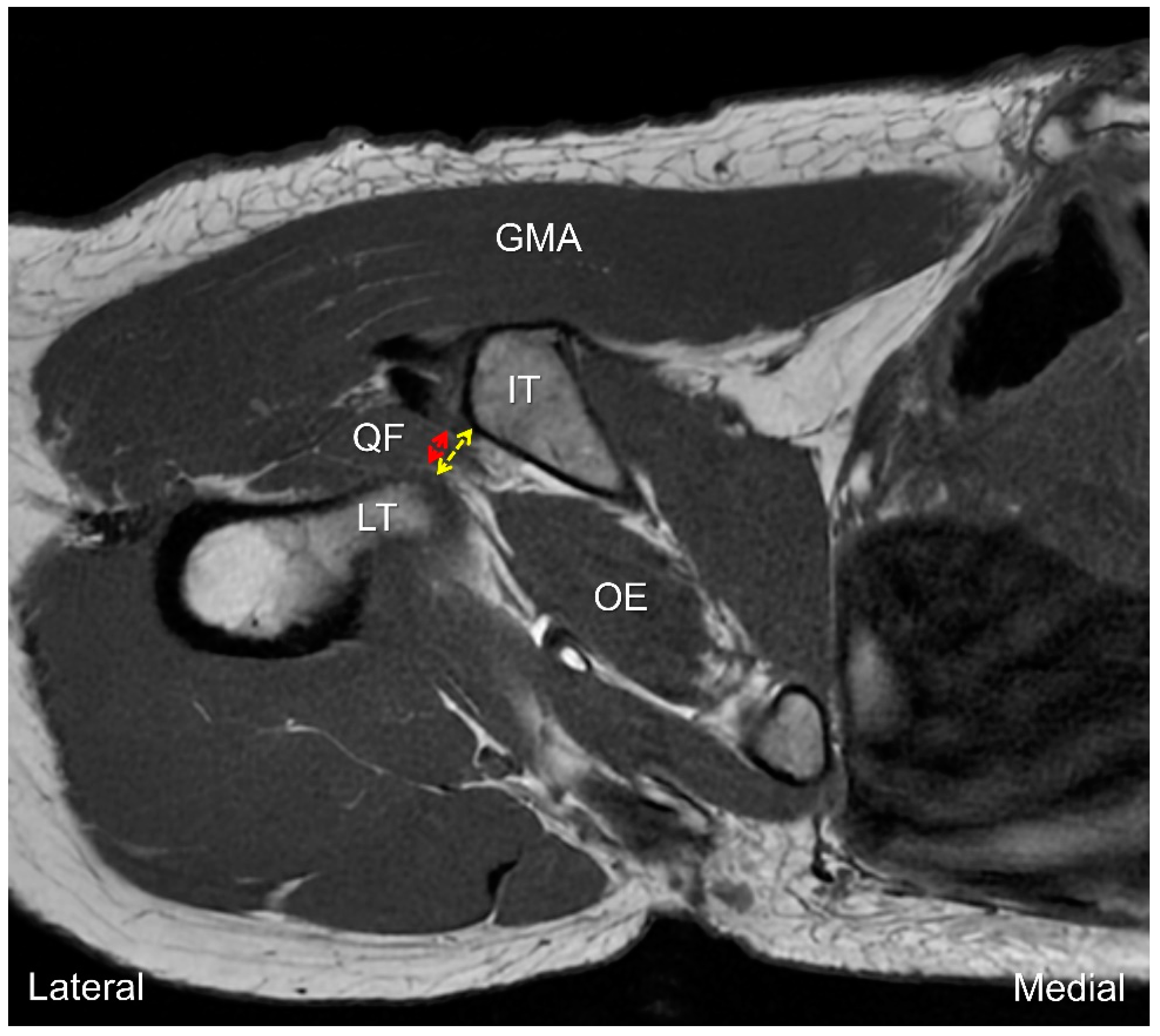 Diagnostics 13 00139 g007 Diagnostics 13 00139 g007