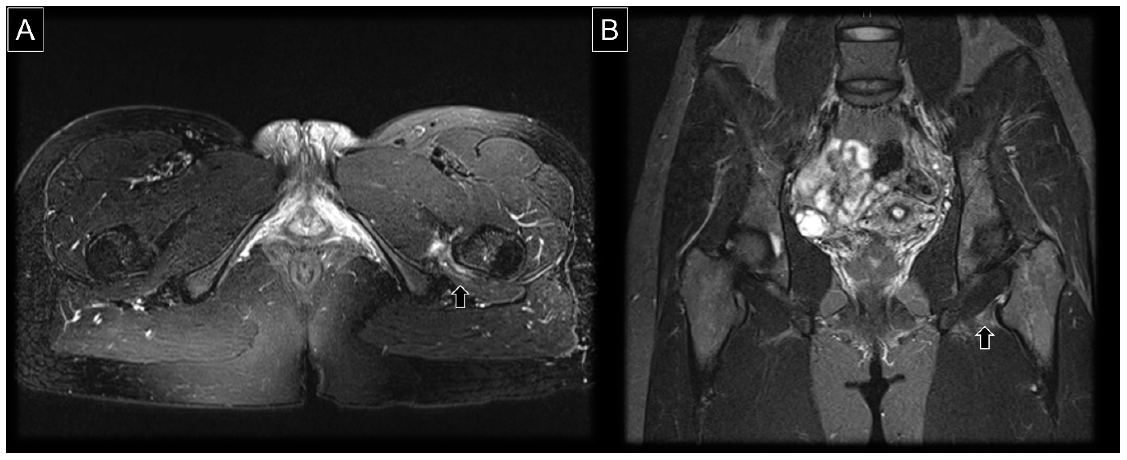 Diagnostics 13 00139 g008 Diagnostics 13 00139 g008