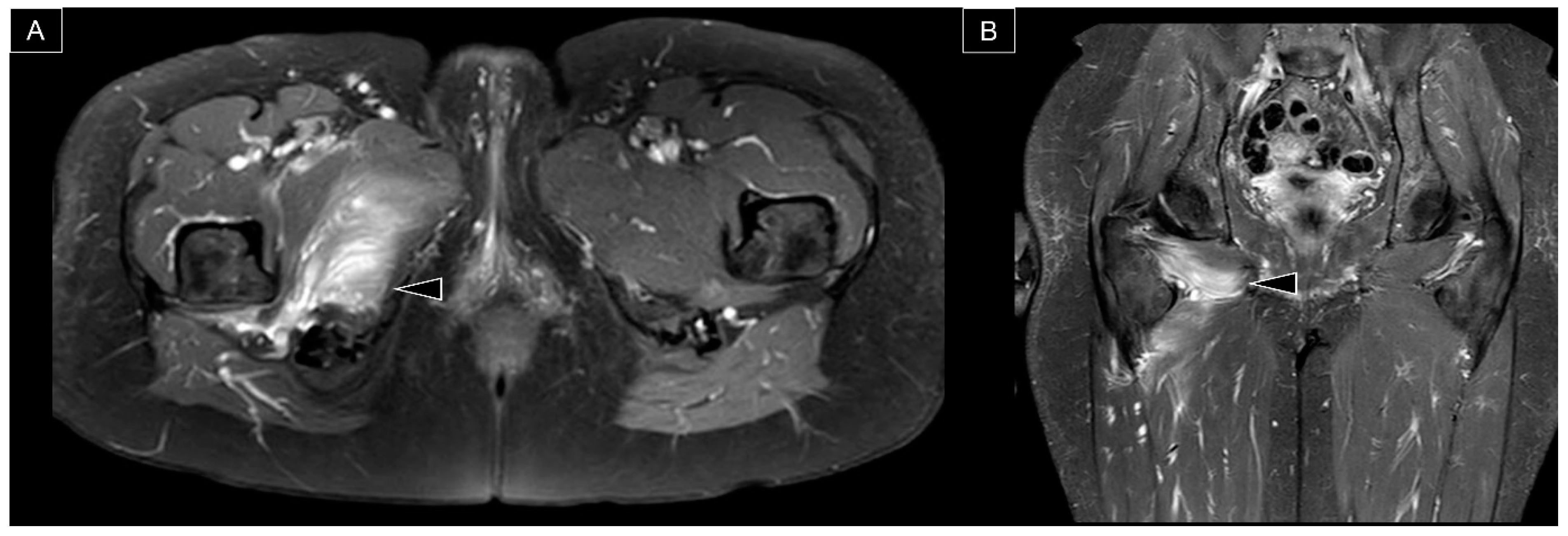 Diagnostics 13 00139 g009 Diagnostics 13 00139 g009