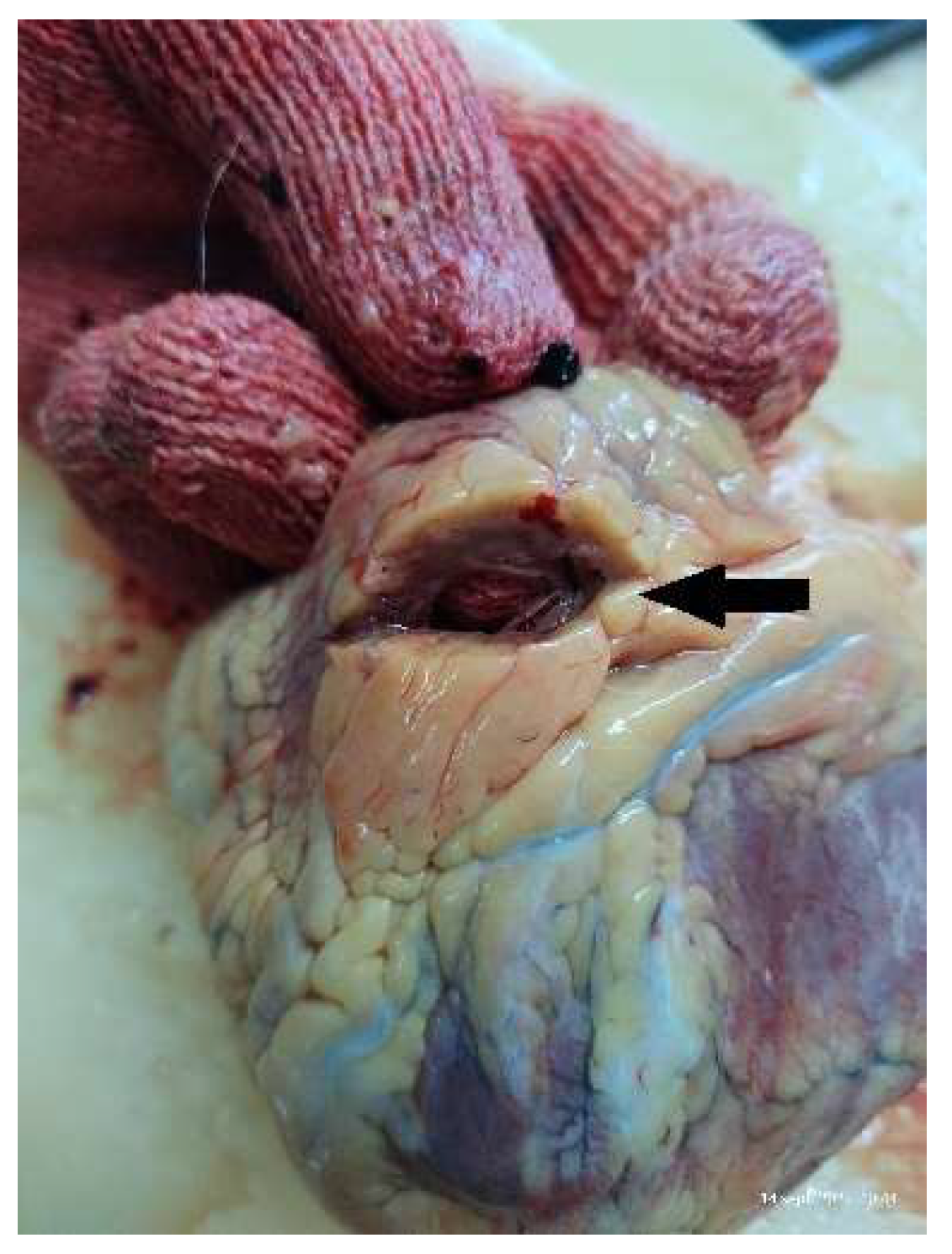 Diagnostics 13 00142 g002 Diagnostics 13 00142 g002