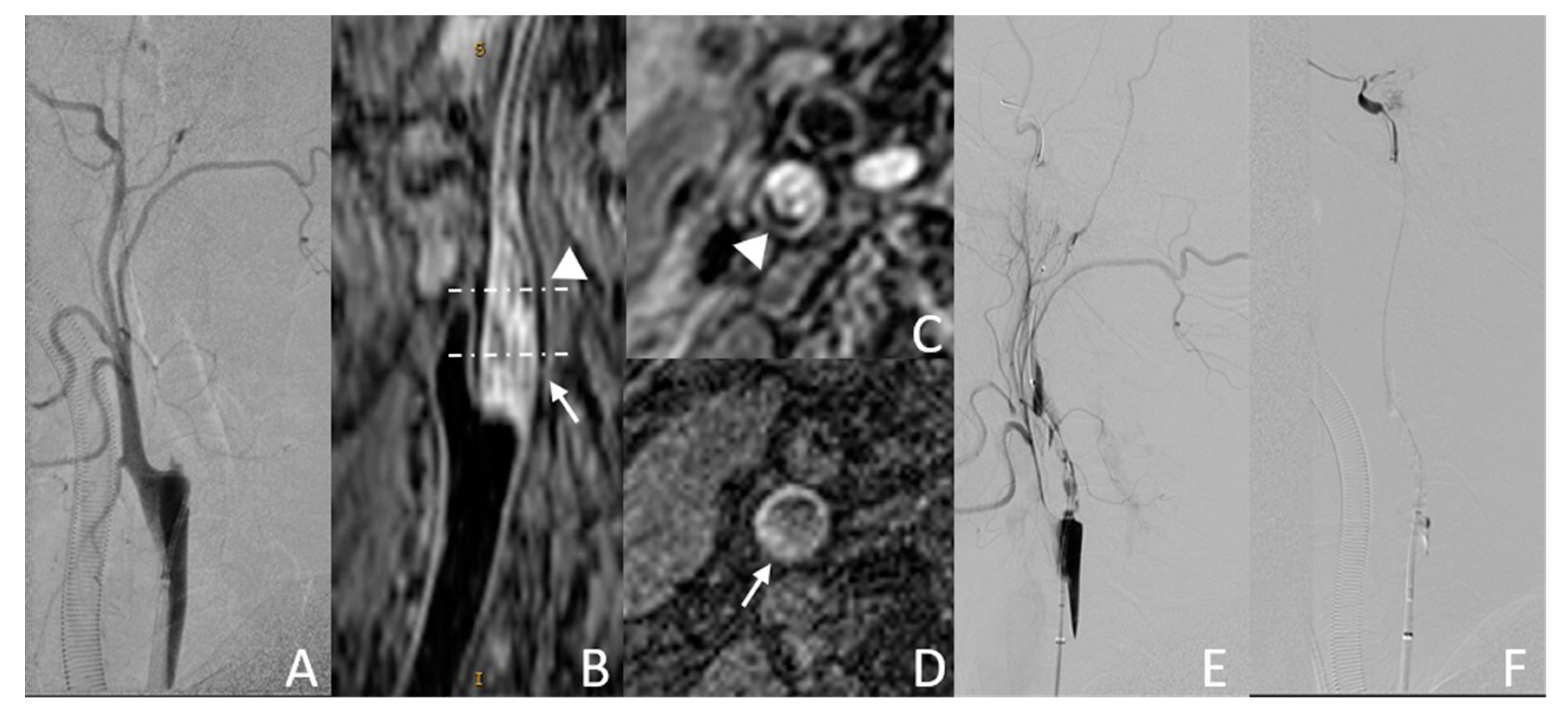 Diagnostics 13 00147 g003