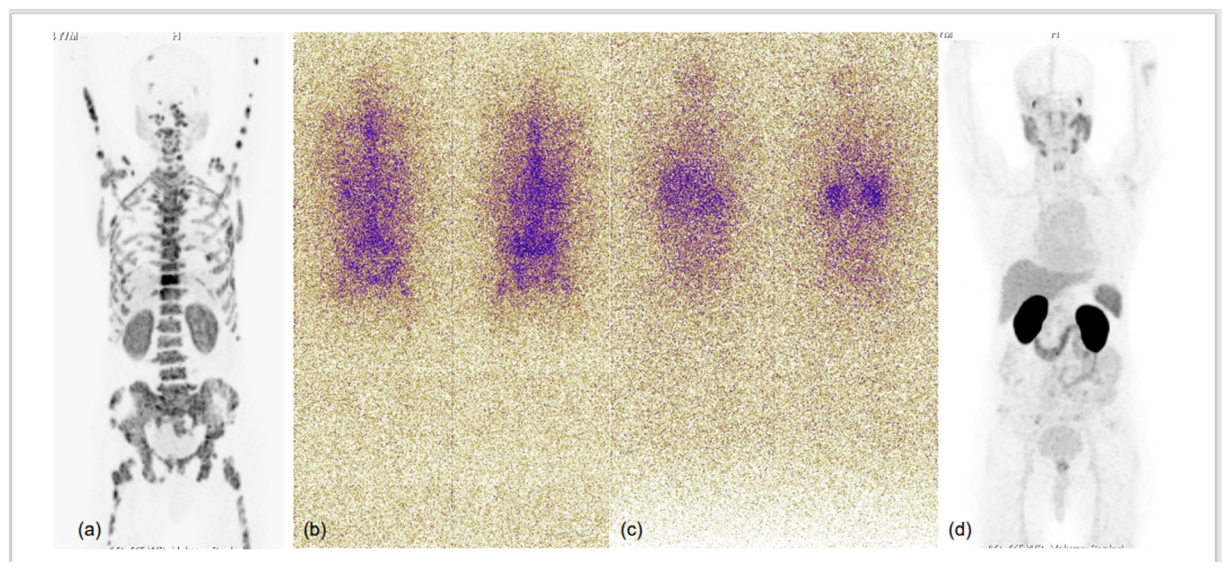 Diagnostics 13 00158 g004 Diagnostics 13 00158 g004
