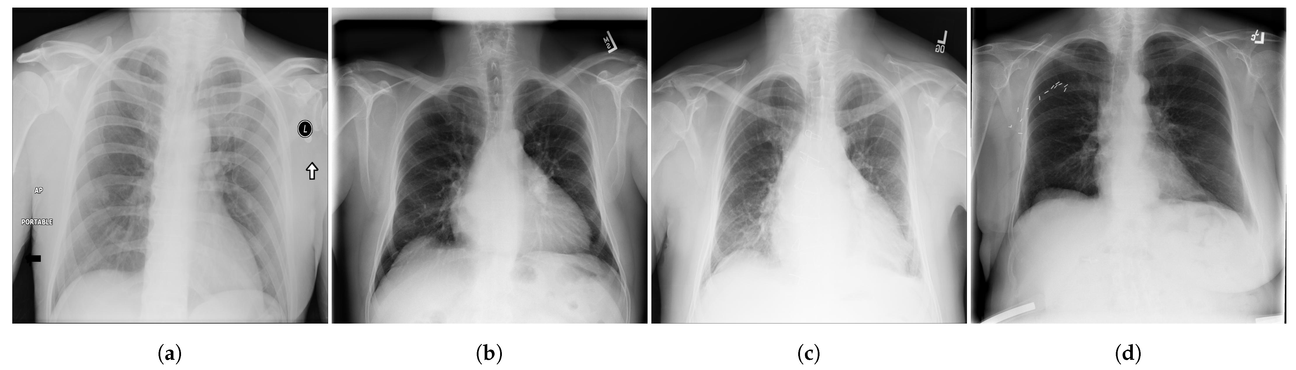 Diagnostics 13 00159 g002 Diagnostics 13 00159 g002