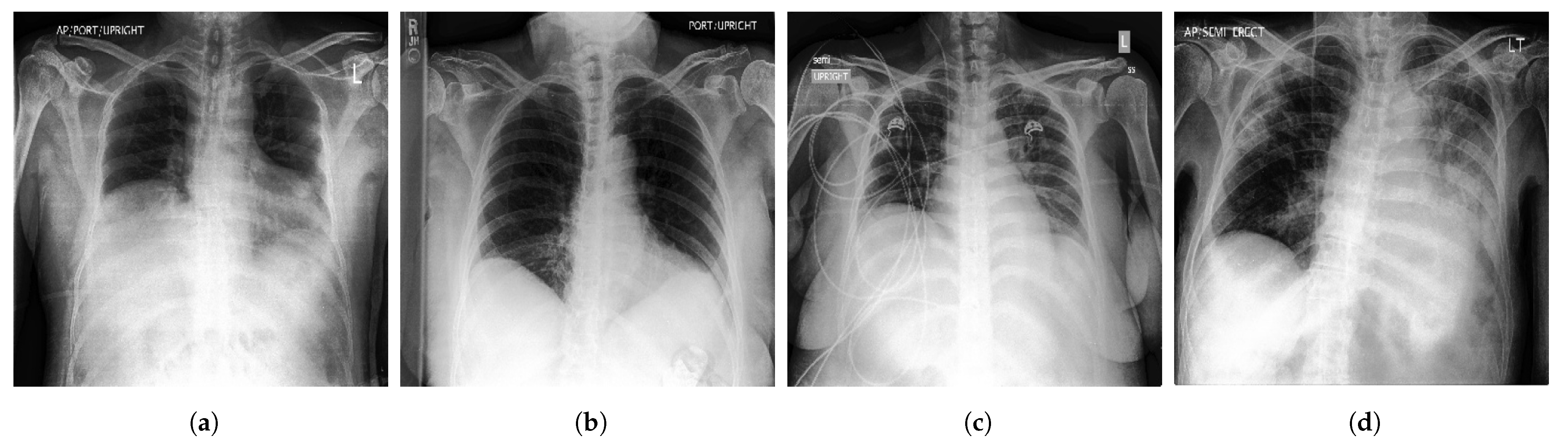 Diagnostics 13 00159 g003 Diagnostics 13 00159 g003