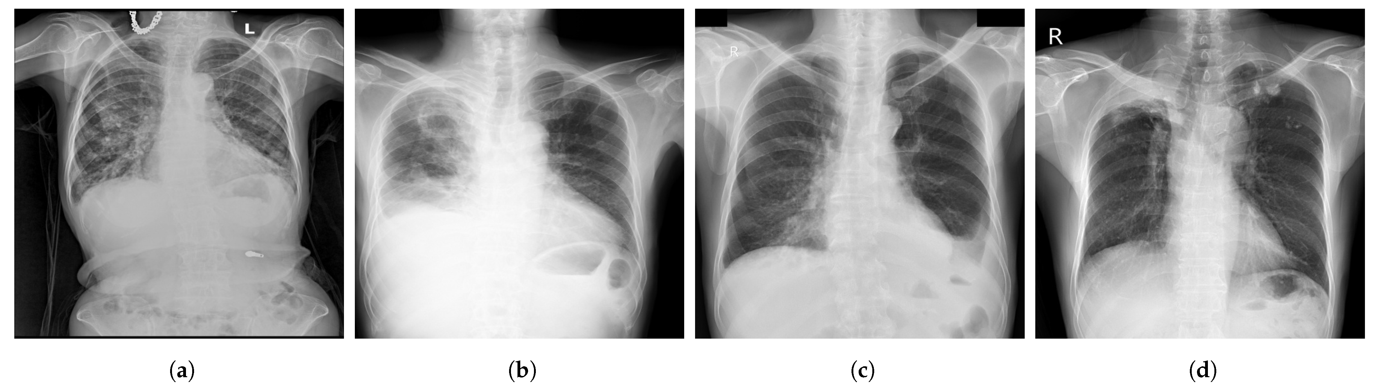 Diagnostics 13 00159 g004 Diagnostics 13 00159 g004