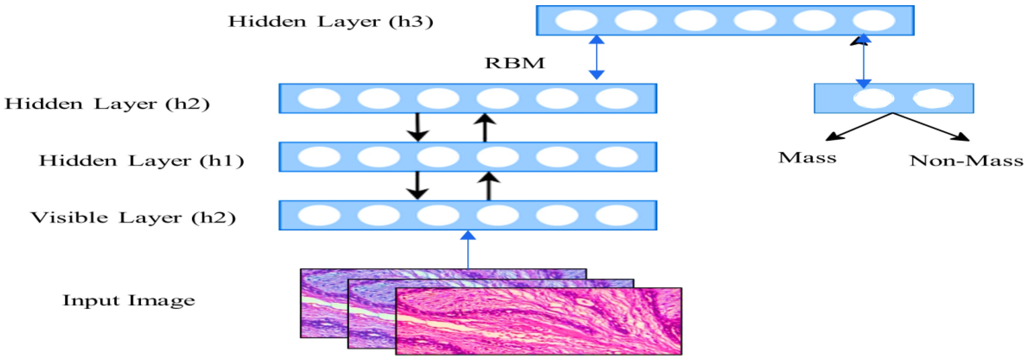 File:Normal breast histology.png - Wikipedia