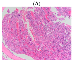 Diagnostics 13 00163 i001