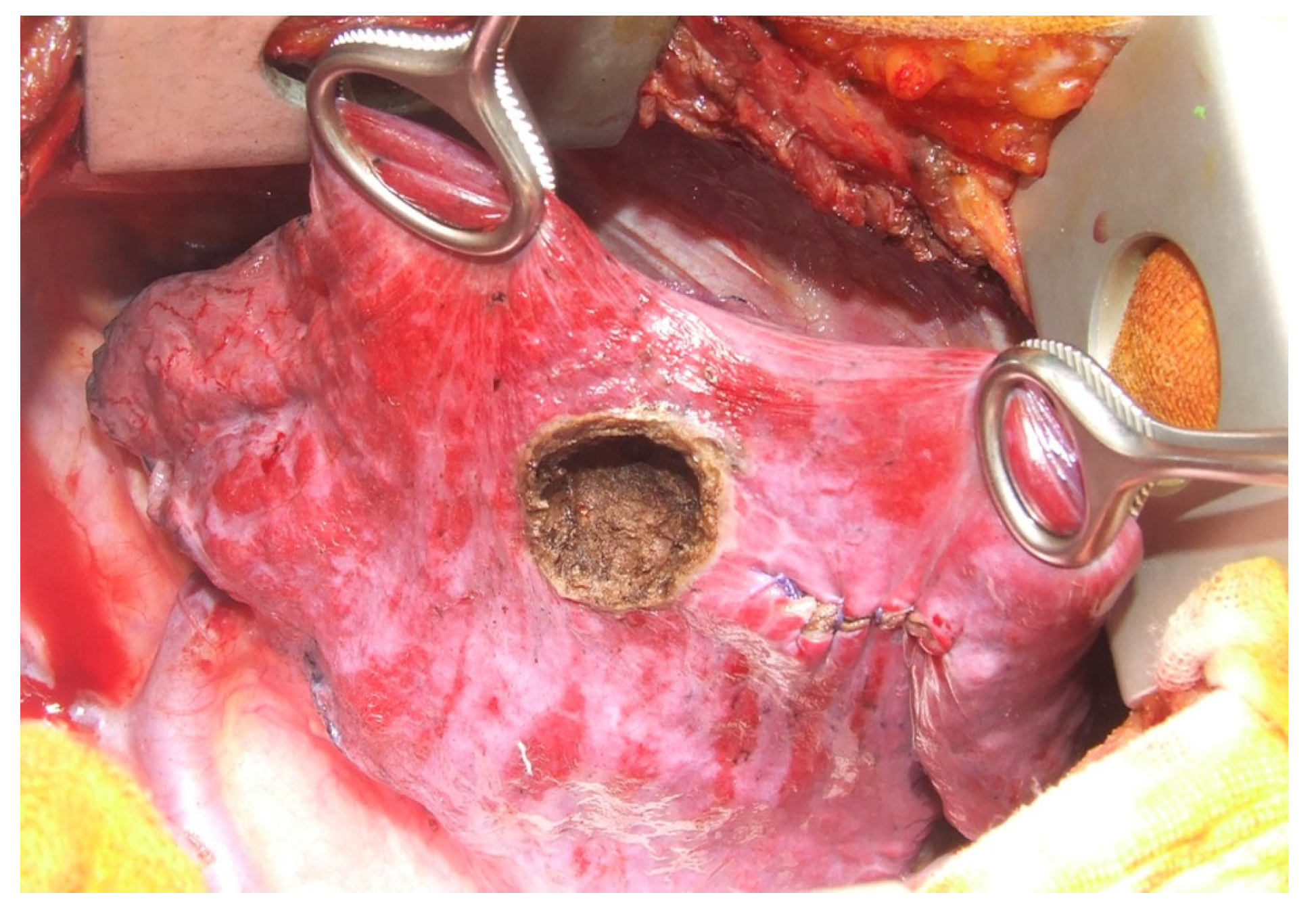 Diagnostics 13 00165 g007 Diagnostics 13 00165 g007