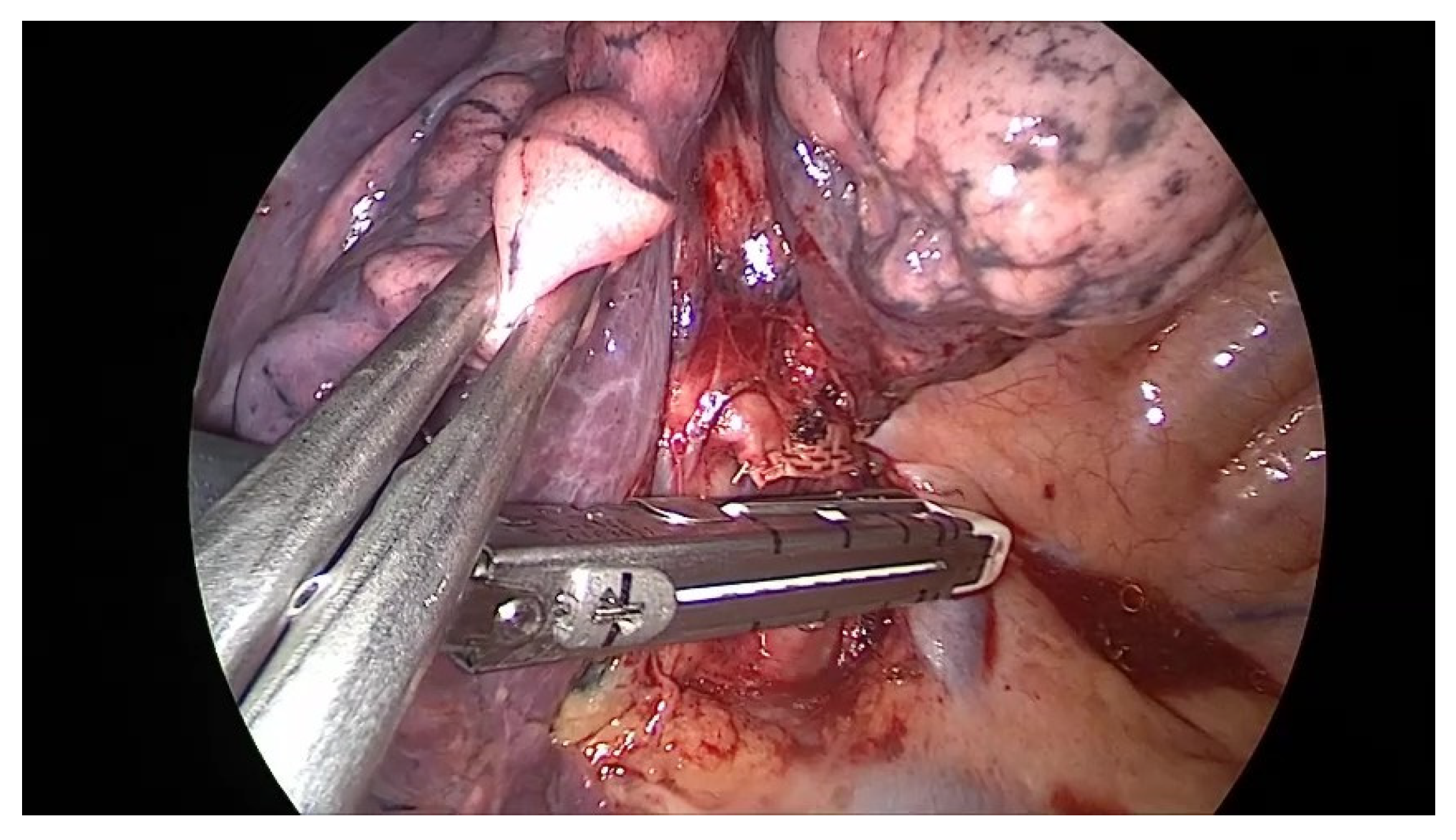 Diagnostics 13 00165 g008 Diagnostics 13 00165 g008